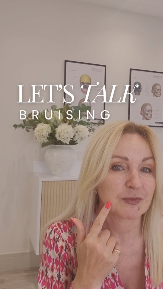 Let’s talk bruising! 👇
Our lovely Hayley wanted to share a little reminder that bruising after filler treatments is completely normal.
Some people don’t bruise at all, while others may notice a little mark or two — both are totally normal following an injectable treatment.
These usually fade within a few days as your body heals, so it’s not something to be worried about. However, here are some tips to help avoid bruising:
⏳ Avoid alcohol and blood-thinning medications (like aspirin/ibuprofen) for 24–48 hours before treatment (unless prescribed by your doctor).
🧘♀️ Come to your appointment calm and hydrated — stress and dehydration can make bruising more likely.
🛑 Skip intense workouts, saunas, or hot showers for 48 hours after treatment.
🧊 Keep the area cool with a cold compress if required after 12 hours but do not apply ice directly to the skin.
And remember — if you are ever unsure or concerned, we’re always here to guide you.
Your safety and care will always be our top priority 🤍
•
•
•
#aftercare #fillertreatment #bruising #filler #injectables #aesthetictreatment #advice #fillers #skindoctor