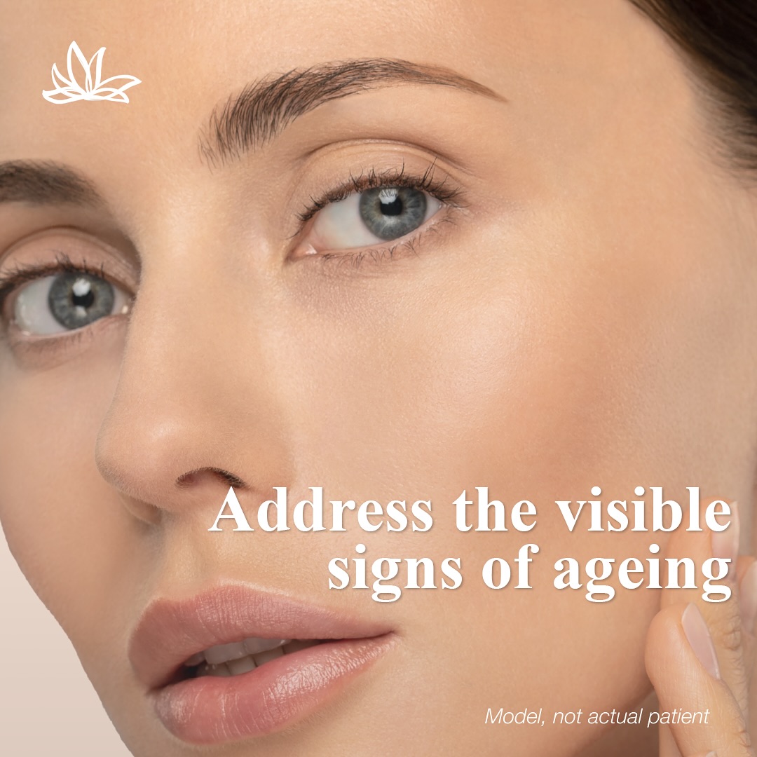 Want a sharper, more defined jawline without going under the knife? 💫
Thermage FLX uses advanced radiofrequency technology to tighten and contour skin from within. By boosting collagen production, it restores firmness where you need it most — helping lift sagging jowls and redefine your natural jawline.
Results develop gradually over the weeks following treatment, looking natural and refined — never “overdone.” Just a refreshed, sculpted version of you.
✨ One session. No downtime. Long-lasting results.
#ThermageFLX #JawlineContouring #NonSurgicalFacelift #SkinTighteningLondon #YouthfulGlow #CollagenTherapy