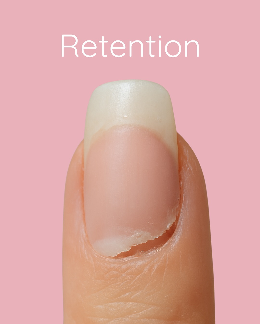 Ever had a set lift way too soon? 😩 That’s a retention issue.
Retention is how well your product sticks to the natural nail. If it’s not bonding right, you’ll see lifting, peeling, or nails popping clean off.
Bad retention usually comes down to:
✨ Prep not being spot on.
✨ Using the wrong primer or skipping it.
✨ Product applied too thick, thin, or flooding the cuticle.
✨ Clients picking, biting or skipping aftercare.
With the right prep, correct products, and a bit of client education, your sets can last well.
Want to learn how to nail retention every time?
Visit glamourphile.com to see your options for training with me 💅