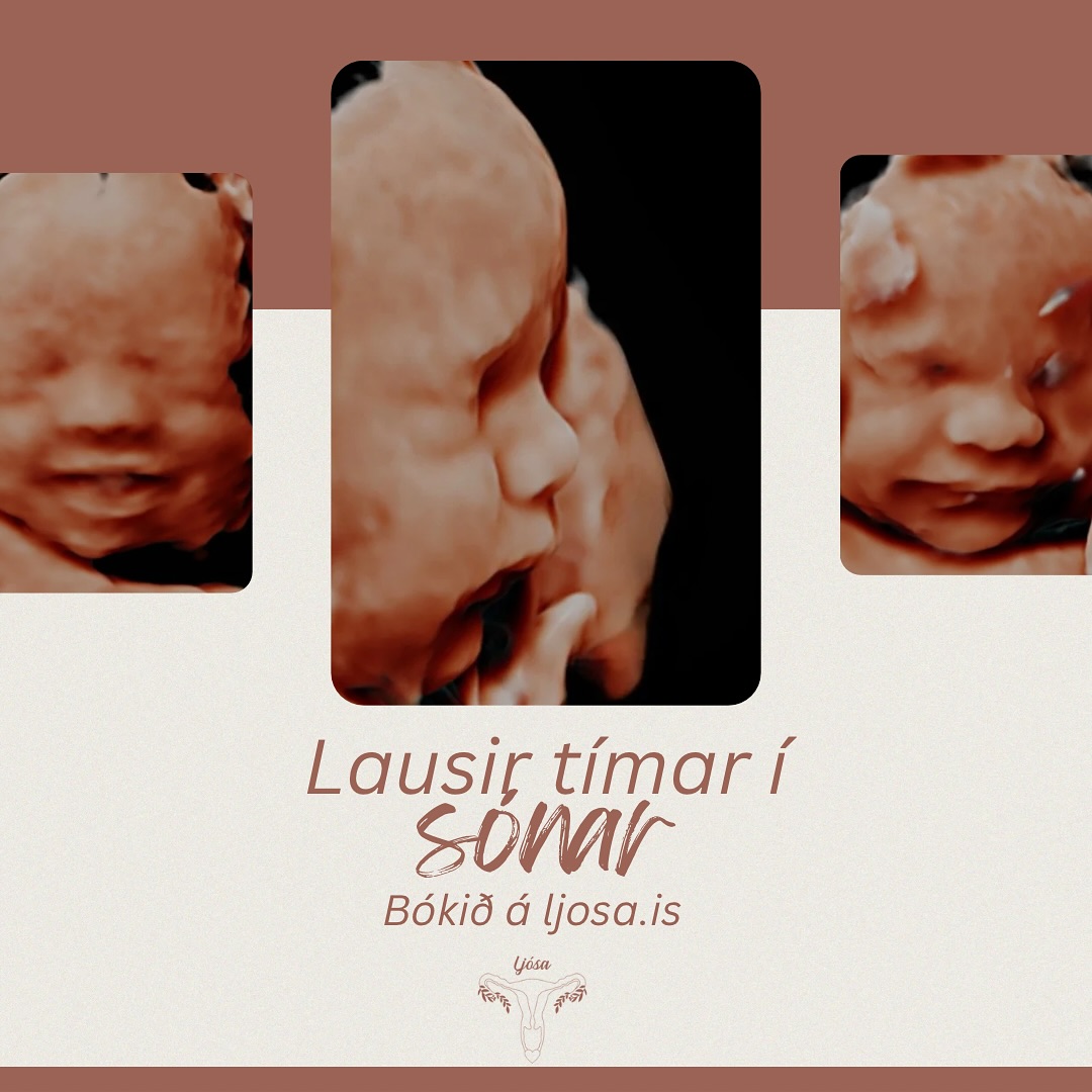 Endilega tryggið ykkur tíma tímanlega en það styttist í að ég bæti við tímum í október og nóvember 🤍
Kynjasónar frá 13-14 vikur og svo hefðbundinn kynjasónar frá 16 vikum, þrívíddarsónar og örsónar eru í boði 👌🏻
Námskeiðin eru á sínum stað og bumbuhittingar!