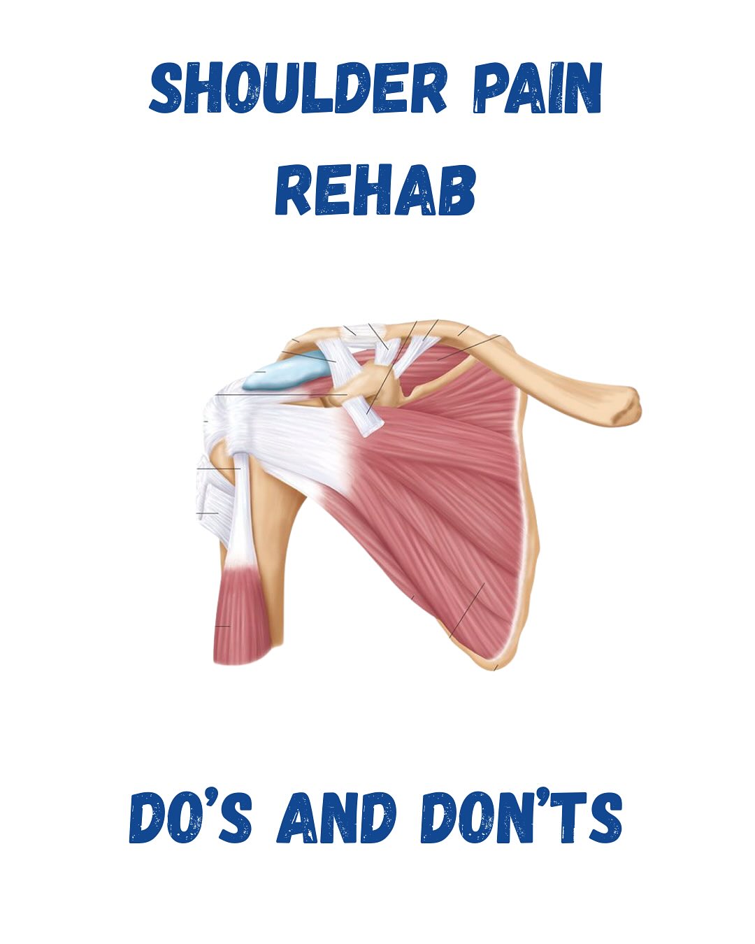 Shoulder Pain Sucks!
As someone who has dealt with shoulder pain on and off, it can really hinder your ability to do the things you love.
Rehab for the shoulder doesnât have to be that complicatingâregardless of whether itâs an scute injury or chronic pain.
Here are a few quick Doâs and Donâts:
â
Make sure the issue is not stemming from a problem in the cervical spine.
đ« Recommend a patient to completely stop lifting weights or doing daily activities that involve the shoulder. This is case-by-case, but as a general recommendation, in most cases stopping all activity for a prolonged time frame will do more harm than good.
â
Program shoulder/cuff strengthening exercises using strength training principles. Meaning: PROGRESS the exercise beyond the yellow band.
đ«Order unnecessary MRI. A trial of care using progressive exercise and treatment can cut costs and reduce surgery when not indicated.
#shoulderpainrelief #shoulderpain #rehab #rehabchiro #bocaraton