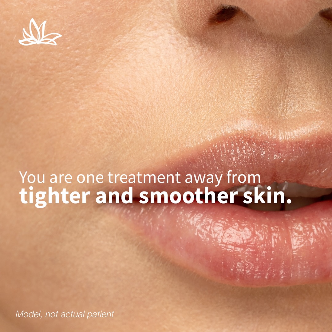 Imagine a facelift without surgery. That’s Thermage FLX.
With just one session, Thermage FLX tightens, lifts, and contours your skin while stimulating collagen for results that can last a year or longer. 🌟
✨ No needles.
✨ No surgery.
✨ No downtime.
It’s why celebrities and A-listers swear by it — and now it’s available right here in London.
If you’re ready for a treatment that delivers real, natural-looking results, Thermage FLX is the secret you’ve been waiting for.
#ThermageFLX #NonSurgicalFacelift #SkinTighteningLondon #CelebritySkinSecret #CollagenBoost #LondonClinic