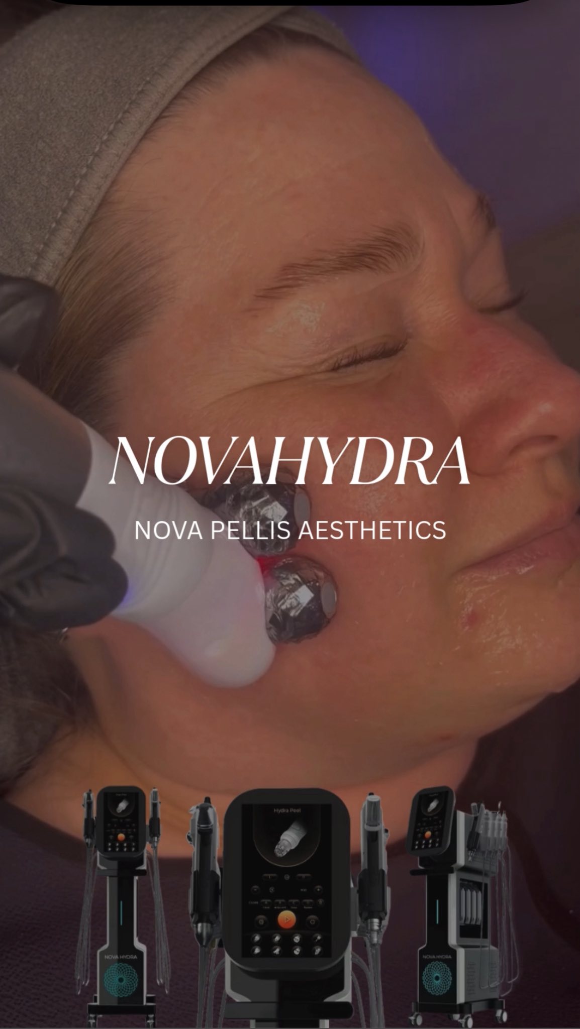 Add the Nova Hydra Facial Device to Your Clinic or Salon 💖
Boost results. Impress your clients. Grow your revenue.
With 10-in-1 technologies including Micro Lift and Radio Frequency, Nova Hydra delivers visible skin rejuvenation with zero downtime, making it a must have for your clinic or salon.
✨Advanced facial technology
✨Repeat bookings
✨High client satisfaction
📩Get in touch with Nova Pellis Aesthetics today to learn more.
🌐www.novapellisaesthetics.com
💌info@novapellisaesthetics.com
📱0800 009 6397
📱WhatsApp 07497 831533
#novahydra #novapellis #microlift #radiofrequênciafacial #glowingskin #skintighteningtreatment #training #clinicowners #salonowners #skinhealth #bespokefacial