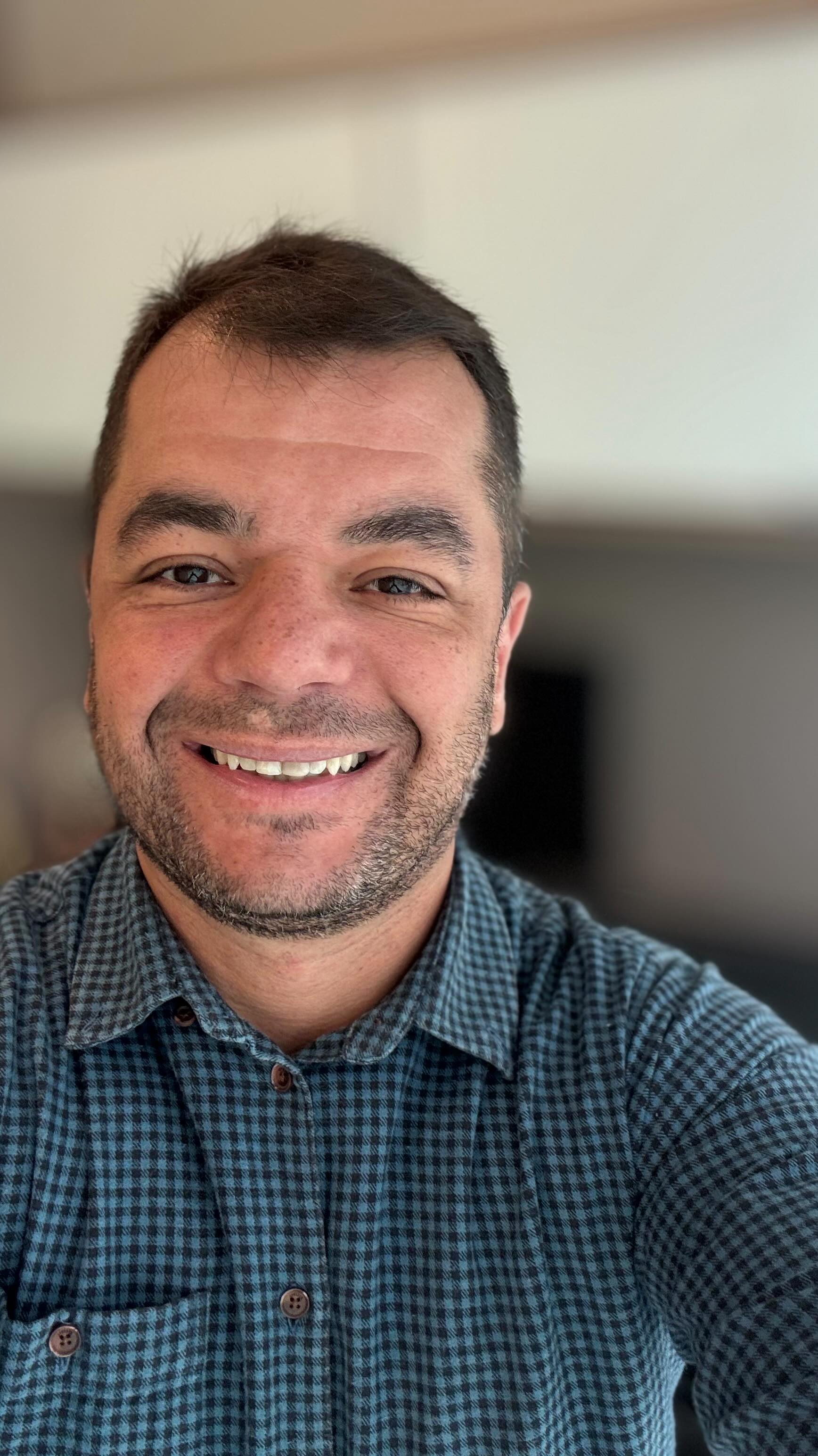 O seu médico lhe explicou sobre as possíveis complicações relacionadas ao procedimento a ser realizado?! Assista aqui sobre complicações cirúrgicas, pegando gancho no excelente post do amigo @drleonardostam 👊🙏 #cirurgiavascular #escleroterapia #espumadensa #varizes #carotida #aneurisma