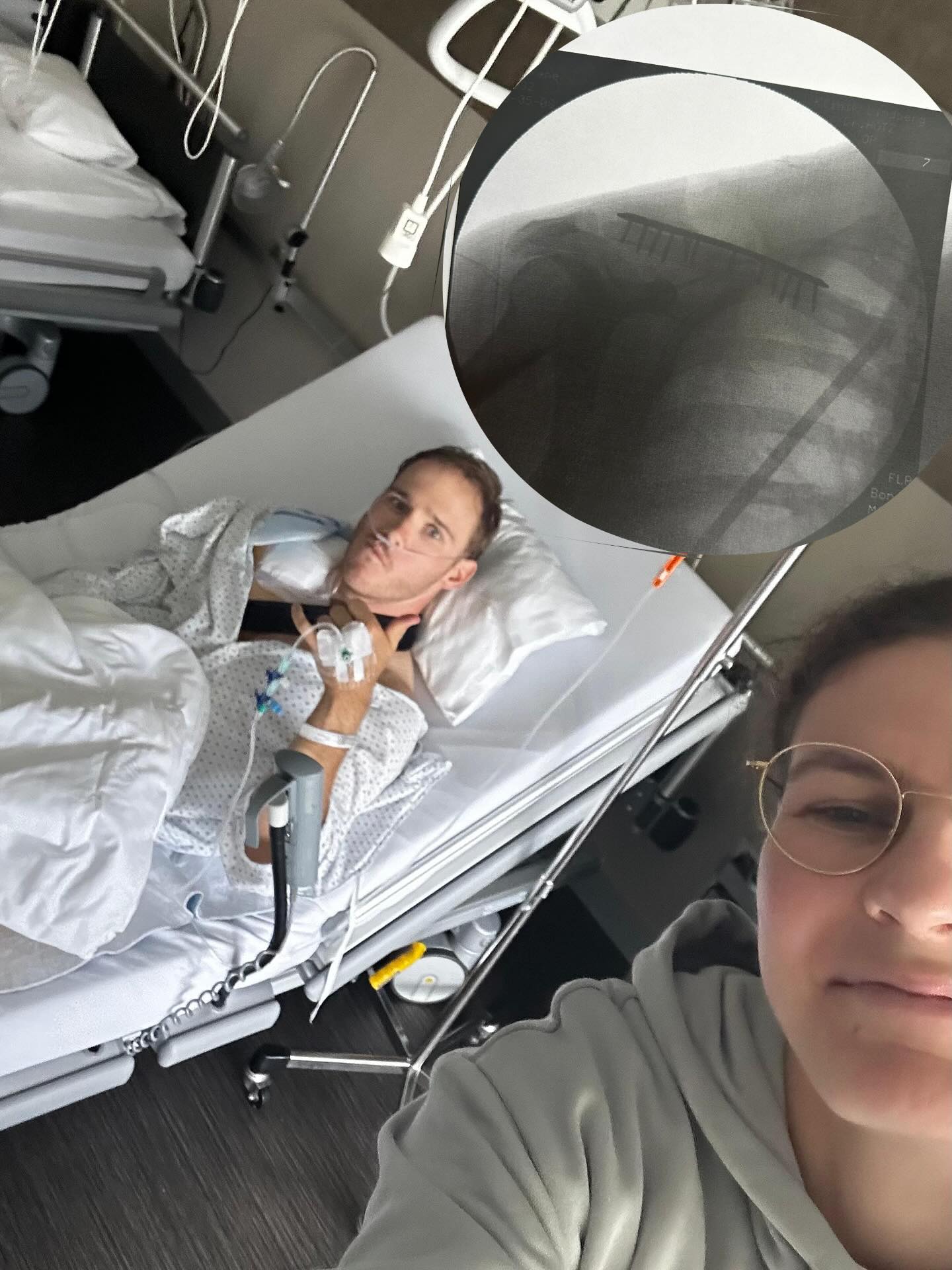 Just like that my 2025 season is over. In a self inflicted bike crash I broke my collarbone 💥. Sometime these things happen… I hope to bounce back soon and start a clean and consistent build up towards the 2026 season.
Thanks to everyone who is with me on the rollercoaster 🎢🫶.