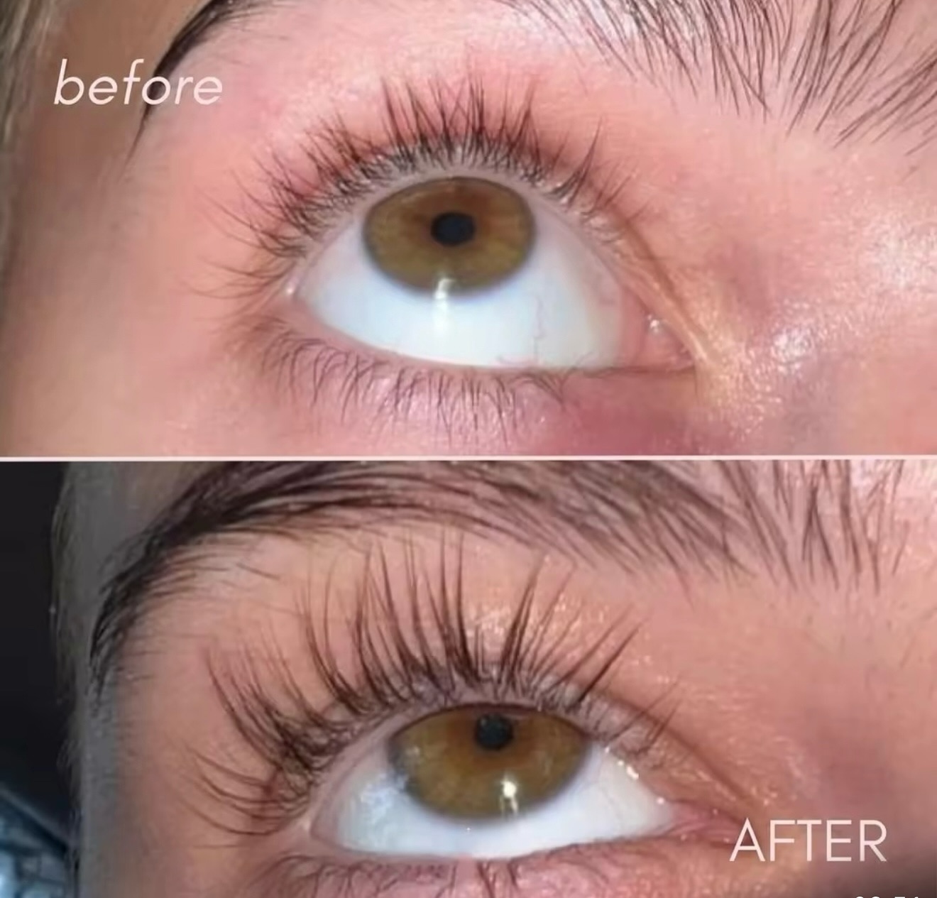 ✨ Sapņu skropstas sākas šeit! ✨
Vai zināji, ka tikai daži pilieni ikdienā spēj pārvērst Tavu skatienu?
🌱 Auravie Skropstu augšanas serums – Tavs skaistuma sabiedrotais:
💖 Garākas un biezākas skropstas
💖 Dabisks spīdums un spēks
💖 Rezultāti, kas liek aizmirst par mākslīgajām skropstām
👉 Sāc savu skropstu ceļojumu jau šodien ar #AuravieGlow ✨