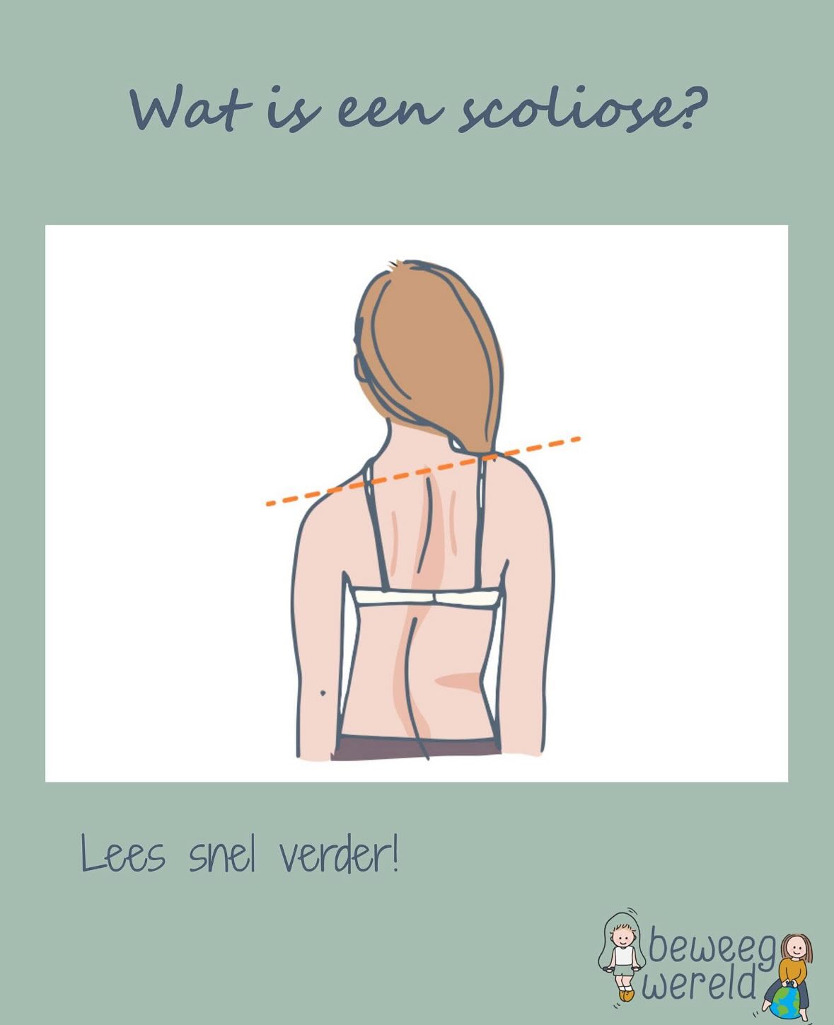 Al een lange tijd volgen wij de Facebook en Instagram pagina van @beweegwereld
Het is een online portaal voor (kinder) therapeuten die kinderen en ouders willen stimuleren om oefeningen te doen en in het dagelijks leven het geleerde toe te passen.
Deze post vond ik interessant: Heb je op het strand of bij het zwembad afgelopen zomer iets opvallends aan de rug van je kind gezien? Wees alert op een mogelijke scoliose. Lees er hier alles over.
Dank @beweegwereld voor jouw input!🙏
#goedbewegenkunjeleren #metplezierleerjemeer #welkomineenwereldvolbeweging #beweegwereld #ehealth #kinderfysiotherapie #kinderoefentherapie #kinderergotherapie #kinderkinesitherapie #psychomotorischkindercoach #leerkracht #remedialteaching #ontspanning #motorischeontwikkeling
#sensorischeinformatieverwerking #kinderfysio #kinderoefentherapeut