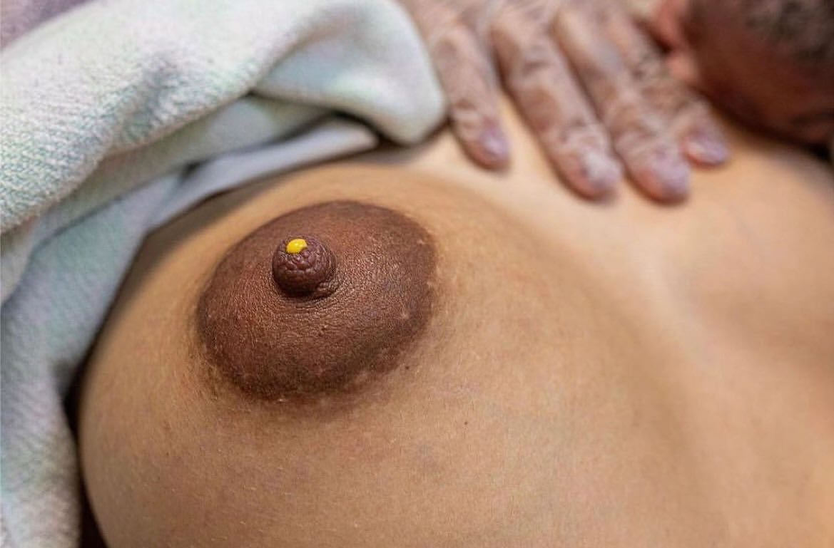 🍯𝐂𝐎𝐋𝐎𝐒𝐓𝐑𝐔𝐌🍯
You don’t need to “wait for your milk to come in” after you give birth.
This sentence is thrown around often and not only is it misleading, it has ruined many lactation journeys.
People believe they are actually starving their child while they “wait for milk to come in”. It often leads to unnecessary formula feeding.
𝐘𝐎𝐔 𝐀𝐋𝐑𝐄𝐀𝐃𝐘 𝐇𝐀𝐕𝐄 𝐌𝐈𝐋𝐊 that your body starts producing while you’re pregnant it’s called Colostrum.
Colostrum IS milk. It’s your body’s first milk.
And it’s exactly what your baby needs and is plenty for them in those first few days even when though it’s measured in small amounts.
Your baby’s tummy is the size of a marble when they are born. That’s it.
After those first few days, your colostrum will move into its transitional milk phase and then it will turn into mature milk.”
Repost from @badassmotherbirther
#newmom #newmommy #newmoms #newmomlife #newmommylife #firsttimemom #firsttimemum #mumsofinstagram #mumssupportingmums #momsofinstagram #momssupportingmoms #motherhoodunplugged #motherhoodslens #motherhoodrising #motherhoodthroughinstagram #motherhoodjourney #motherhoodintheraw #motherhood_squares #motherhoodthroughig #motherhoodunfiltered #motherhoodintheraw