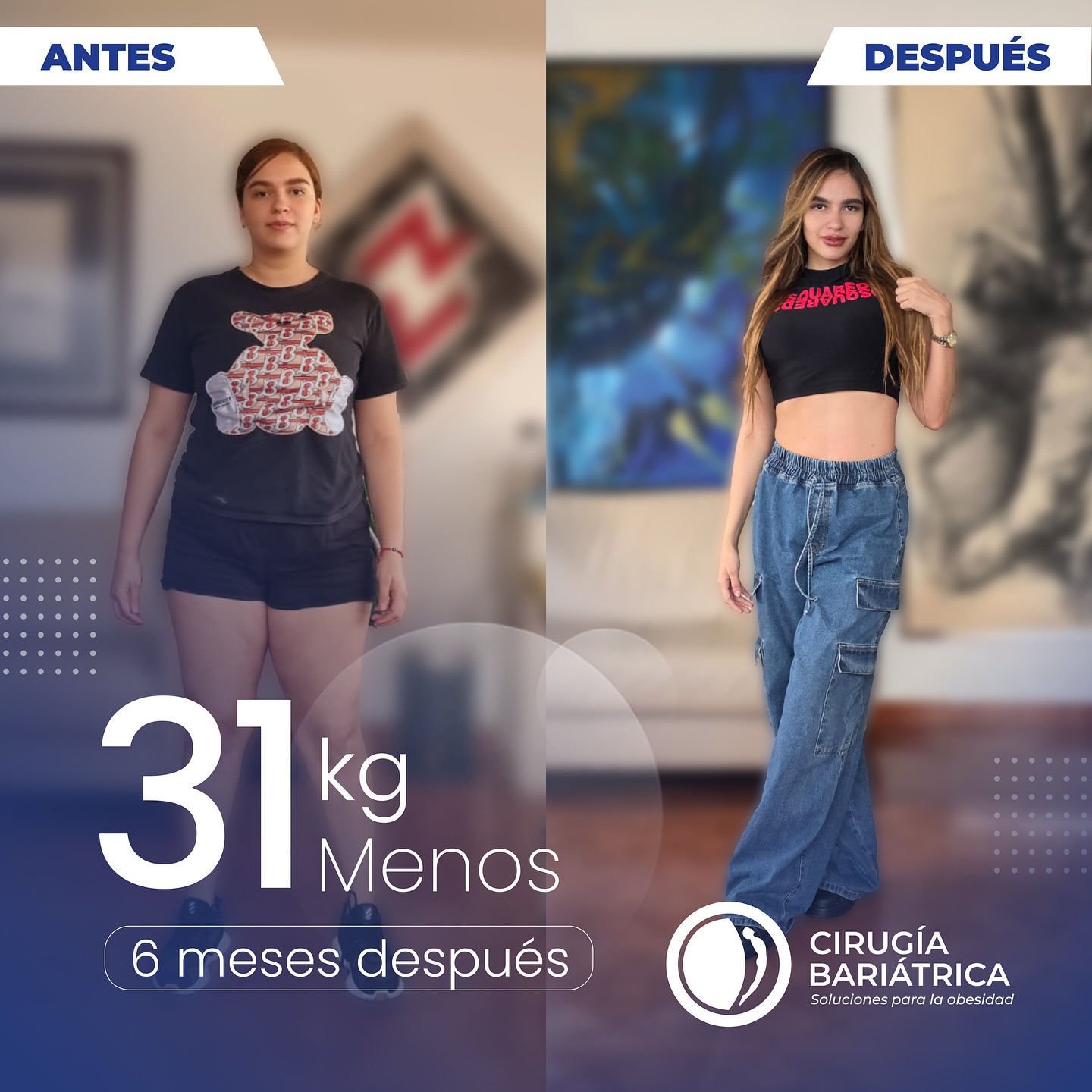 ✨ ¡31 kilos menos en solo 6 meses! ✨ WOOOW!!
Gracias a la cirugía bariátrica del Dr. Bolaños y su equipo de trabajo, reconocidos por su gran calidad humana y tecnológica, esta paciente hoy celebra una transformación llena de salud y bienestar. 💙👏
✨ 68 pounds down in just 6 months! ✨
Thanks to the bariatric surgery performed by Dr. Bolaños and his team, known for their outstanding human quality and advanced technology, this patient now celebrates a transformation filled with health and well-being. 💙👏
#bariatric #bariatrica #surgery #weightlosssupport #weightlossjourney #health #healthy #bajardepeso #weightlosssurgery