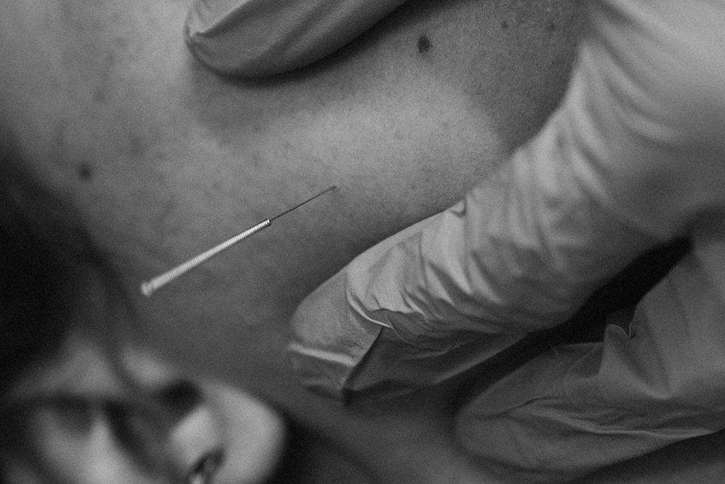 TMJ dysfunction affects the jaw joint and surrounding muscles, often leading to pain, clicking and limited movement. Our physiotherapy treatment includes evidence-based techniques such as dry needling, manual therapy, myofascial release, posture correction and jaw exercises to reduce pain, improve function, and restore normal movement patterns.
•
•
•
#physiotherapy #pretoria #tmj