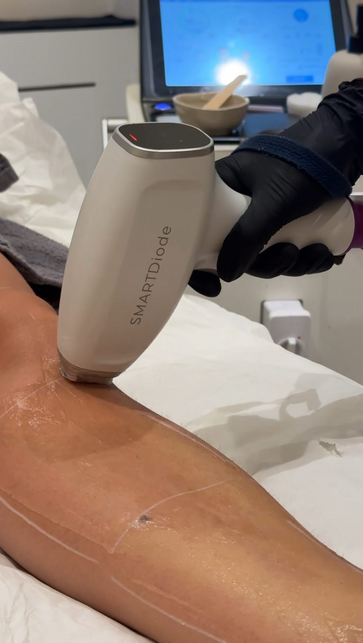 The Best Time to Start Laser? Now 🍂
Start your laser journey now and have your course complete in time for next summer ✨ Smooth, hair-free skin is just a few sessions away!
Click on the book now link on our homepage
☎️ 01483715001
📧 info@laurenelizabethmedispa.co.uk
📲 download our app Lauren Elizabeth Medispa
#laserhairemoval #laseruk #medispa #woking #laserhairremovaluk