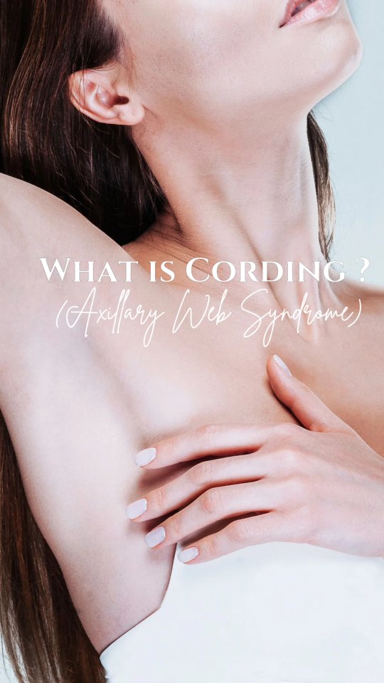 ✨ What is Cording (Axillary Web Syndrome)? ✨
Cording, also known as Axillary Web Syndrome (AWS), is a common side effect after breast or lymph node surgery.
It feels like tight, rope-like bands under the skin that can run from the armpit down the arm, sometimes reaching the wrist. These cords are thought to be hardened lymphatic vessels or scar tissue.
👉 Common symptoms:
Pain or tightness in the armpit or arm
Restricted shoulder movement
Visible or palpable "cords" under the skin
🌿 The good news:
With gentle stretching, movement, and therapies such as Manual Lymphatic Drainage (MLD) and Scar Therapy, symptoms can improve, and mobility can be restored.
💚 Always check with your healthcare provider or therapist for the right approach for you.
✨ Your healing journey is unique. Be patient, kind, and consistent with your recovery. ✨
#MLDuktherapists #ManualLymphaticDrainage #restoreScarTherapy #OncologyMassage #PostSurgeryRecovery #HealingJourney #LymphaticHealth #Cording #AxillaryWebSyndrome #PostOpCare #MassageTherapy #OncologySupport #WellnessJourney #HolisticTherapy #TatjanaSenkova