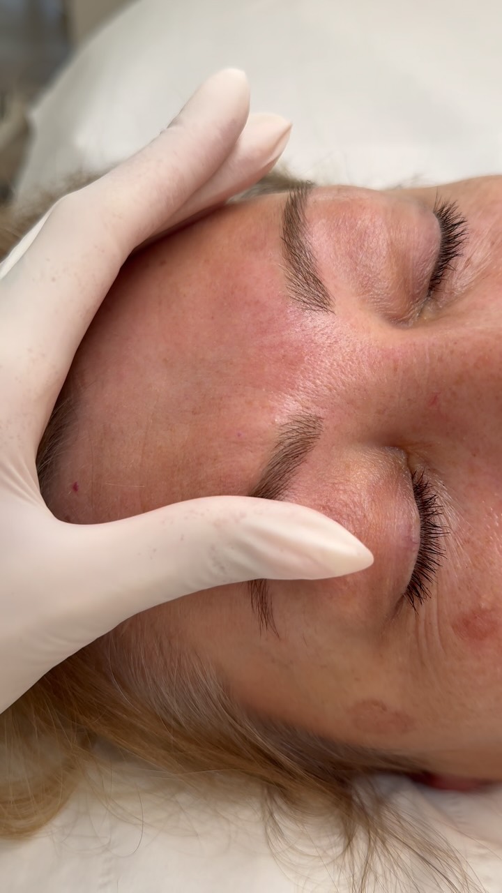 Schade, dass ich vergessen habe ein Video von „vorher“ zu machen :( der Unterschied ist so krass 🤓
Fusionbrows ❤️