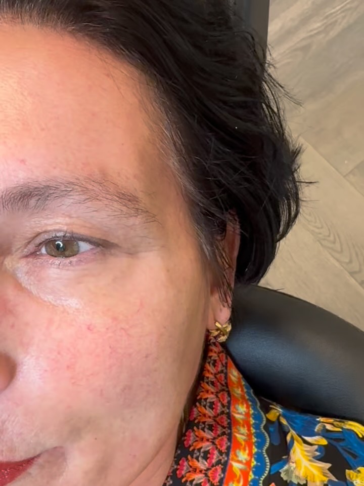 ✨ Nieuwe Powderbrows ✨
Ontdek de kracht van Powderbrows – dé techniek voor perfect gevormde, natuurlijk ogende wenkbrauwen! 🌸
💎 Voordelen van Powderbrows:
✔️ Zacht poedereffect, alsof je wenkbrauwen altijd mooi zijn ingekleurd
✔️ Geschikt voor elk huidtype
✔️ Langdurig resultaat (1,5 – 3 jaar)
✔️ Volle, symmetrische en verzorgde look
✔️ Geen dagelijkse wenkbrauw-stress meer 🙌
Wil jij ook wakker worden met perfecte brows? 💕
Boek nu je afspraak en ervaar het verschil zelf!
Www.sdibrows.nl 06-31763025
#inklessstretchmarksremoval #permanentmakeuplippen #permanentemakeup #pmu #pigment #wenkbrauwen #brows #browbar #sdibrows #miainkt #hairpigmentation #heerhugowaard #oudkarspel #Alkmaar #Noord-Holland #powderbrows #lipblush #lippigmentatie #academy #opleidingen # cursussen #microdermabrasie #microneedling #wax# #fullbodywax#BrowsOnFleek #Selfcare