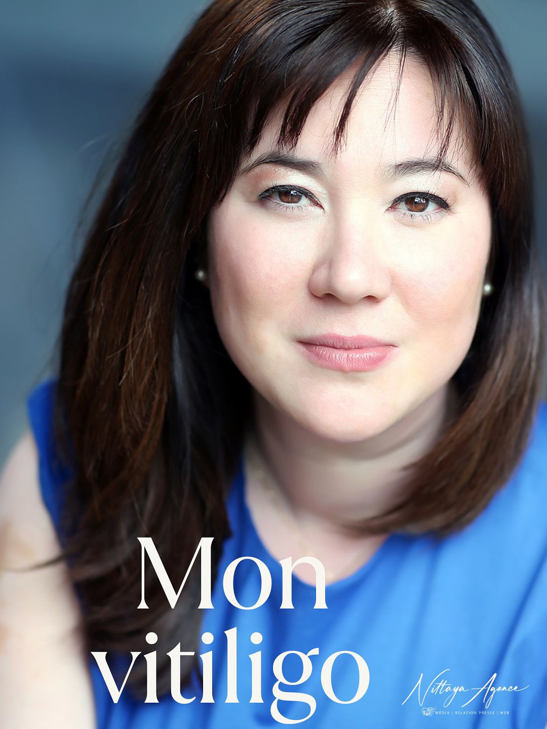 Quand la peau parle plus fort que les mots. Portrait aujourd’hui versus avant le vitiligo.
J’avais 19 ans.
Un choc émotionnel. Un de ceux qu’on croit digérer… mais que le corps, lui, imprime.
Neuf mois plus tard :
➤ une marque au cou
➤ une au coin de chaque œil
➤ une à chaque poignet.
Comme des stigmates.
Puis un matin, en République Dominicaine, mon corps a commencé à blanchir.
Et pendant plus de 20 ans, il n’a plus arrêté.
🩶 Alors on s’adapte.
Des collants chair en plein été.
Des manches longues en voile léger.
5 ans sans aller à la plage.
Des phrases qu’on n’oublie pas prononcées par des Femmes :
“C’est dommage, toutes ces taches… mais t’es quand même jolie.”
Ce genre de phrases qui te collent plus fort à la peau que la maladie.
À 43 ans, j’ai mis du temps à passer de :
→ je me hais
→ je me cache
→ je ne me reconnais plus.
À :
→ je mérite la douceur
→ je m’accepte
→ je sais qui je suis !
Quand on vit une maladie psychosomatique, on apprend à se reconstruire de l’intérieur.
Parce-que ni les dermatologues, ni les crèmes, ni les séances uva-uvb, les consultations où l’on vous scrute comme un vers nu.. vous y aideront.
Mais l’hypnose SAJECE, elle, m’a aidée.
Merci @favre.olivia Merci @camille.griselin
Elles m’ont appris à m’aimer là où je voulais me corriger.
Et il y a ma fille.
Elle ne connaît pas mon visage d’avant.
Elle connaît juste ma vérité actuelle. Et elle la respecte. Elle m’enseigne chaque jour l’amour de soi. Sans mots.
💬 À ceux qui vivent une maladie psychosomatique :
Aimez-vous. Même quand c’est inconfortable. Même quand c’est lent.
💬 À ceux qui ne comprennent pas :
Cessez de juger. La beauté se loge aussi dans l’invisible.
💬 À celles et ceux qui ont du vitiligo :
On est dans la même team.
Et on est magnifiques.🖤
Crédit photo 1 : @crisnoe_photographer
Crédit photo 2 et 3 : @studiofalour