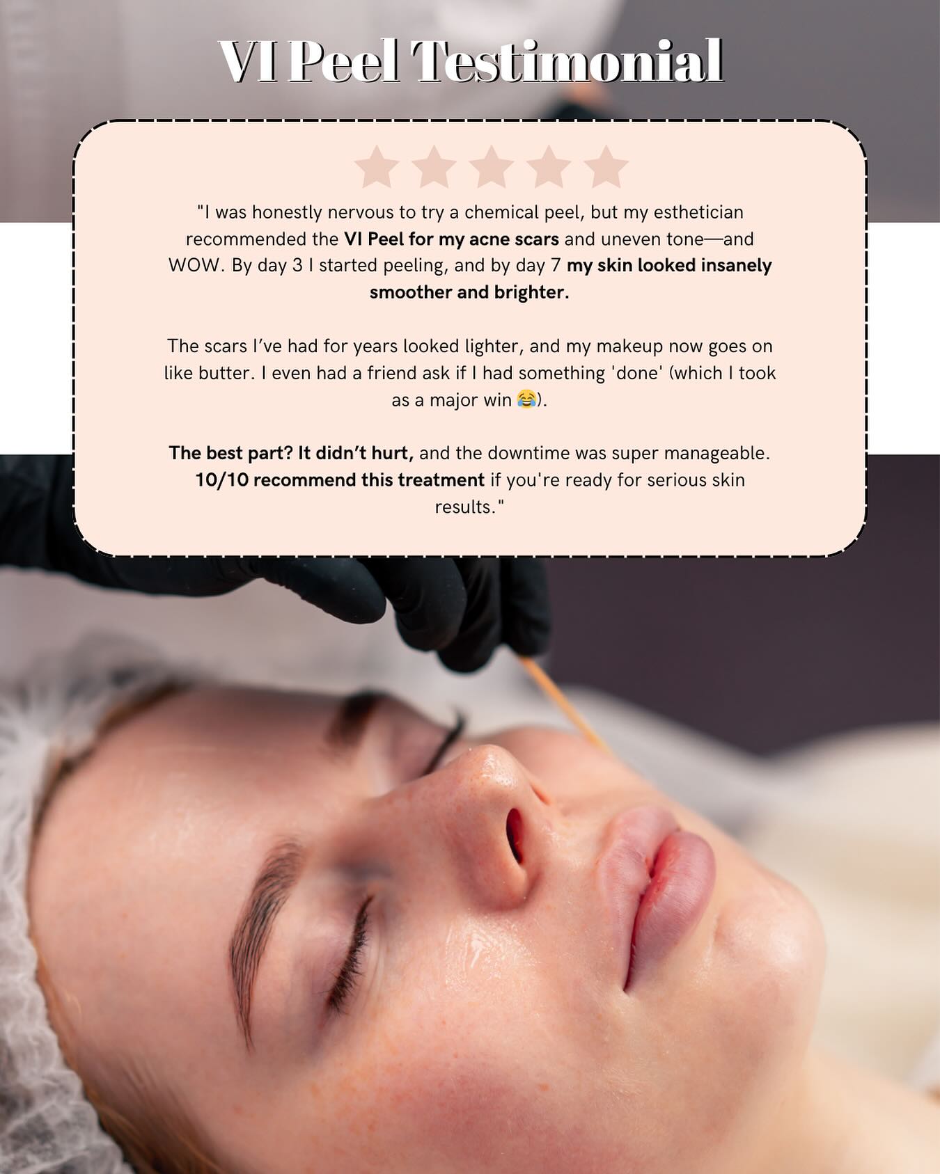 Reviews mean everything. 🥹✨
When a client takes the time to share their real results, real experience, and even a little humor (we see you, “makeup goes on like butter” 👏)—it’s more than just words.
It’s the reminder that what we do really matters. 💖
To every client who leaves a review, snaps a selfie, or tells a friend—you’re the reason we glow too ✨
💬 Tried the VI Peel? Let’s get you scheduled 📆
📲971-375-6381