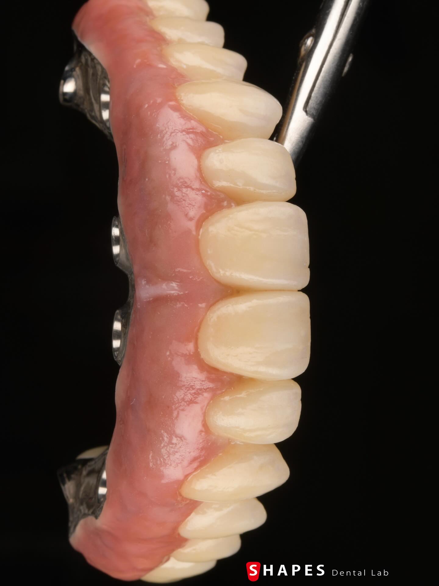 e.max Ceram Gingiva — three buildups (with glaze) create depth and vitality in the final result.
・
・
・
・
・
・
・
・
#toothologyst #dentaltechnician #dentallab #dentistry #smile #smilemakeover #フルマウス#teeth #morphology #layering #allonx#zirconiacrown#emaxceram #ivoclarvivadent #prosthodontics #三島市歯科医院#trios#odontologia #smilecloud #stomatolog #zahnarztl#dentalphotography #gum#dentist#стоматология#Dişhekimi#protetikazuba#singlecentral#straumann#シェードテイキング