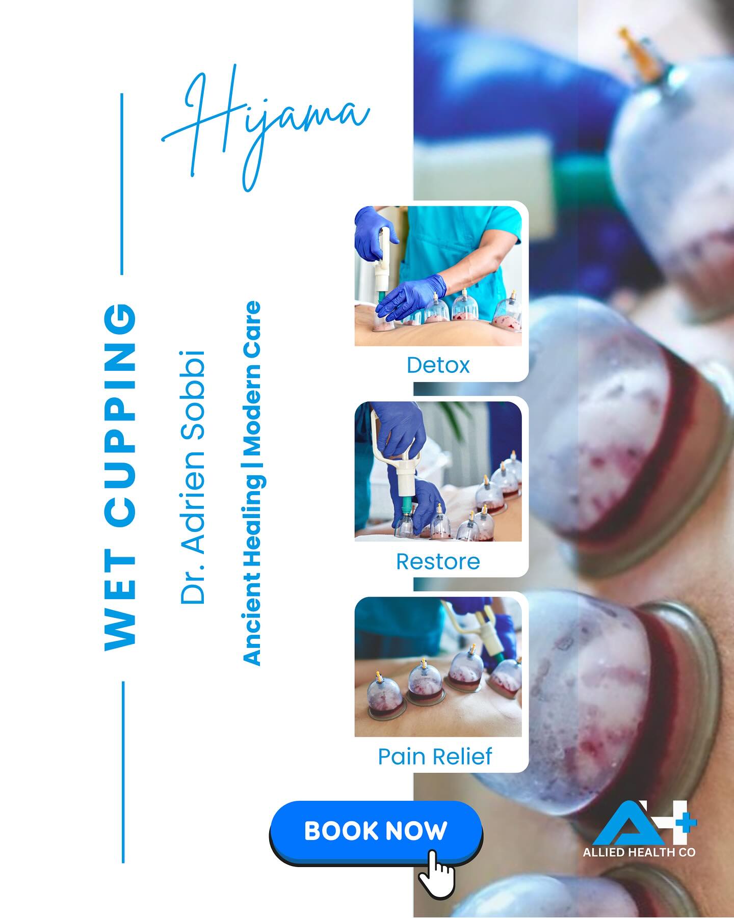 ✨ Detox • Restore • Relieve ✨
Experience the ancient healing of Hijama (Wet Cupping) in a modern, clinical setting with Dr Adrien Sobbi.
✔️ Natural detoxification
✔️ Pain & tension relief
✔️ Improved circulation & energy
🌿 Performed by qualified practitioners in a safe, professional environment.
📅 Limited spots available – Book Now via alliedhealthco.com.au or DM us today!
#Hijama #WetCupping #NaturalHealing #PainRelief #Detox #AlliedHealthCo #SydneyHealth #HolisticWellness