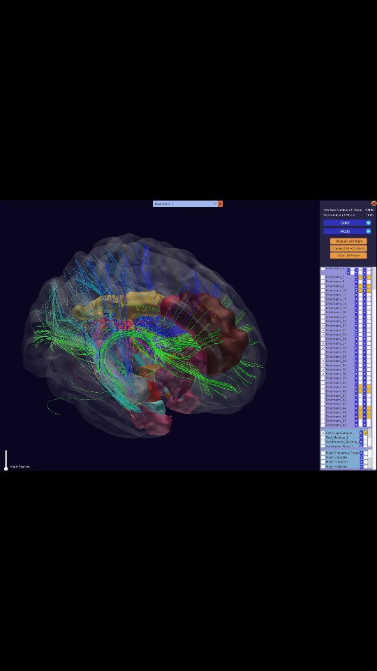 🌙 Tu cerebro y el trauma 🧠💥
¿Sabías que el sistema límbico es el centro emocional de tu cerebro?
Incluye estructuras como la amígdala, el hipocampo y el tálamo, que regulan cómo sentimos, recordamos y reaccionamos.
Cuando vivimos un evento traumático, este sistema puede quedar en estado de alerta permanente ⚡.
➡️ La amígdala se activa en exceso, generando miedo y ansiedad.
➡️ El hipocampo, que organiza los recuerdos, puede alterar cómo recordamos la experiencia.
➡️ Esto da lugar a síntomas del trastorno de estrés postraumático (TEPT):
Recuerdos intrusivos
Pesadillas
Hipervigilancia
Evitación de situaciones que recuerdan el trauma
✨ La buena noticia: el cerebro es plástico y puede sanar. Con psicoterapia, técnicas de regulación emocional y apoyo adecuado, es posible recuperar el equilibrio.
💬 Cuidar nuestra salud mental es tan importante como cuidar el corazón o los pulmones.