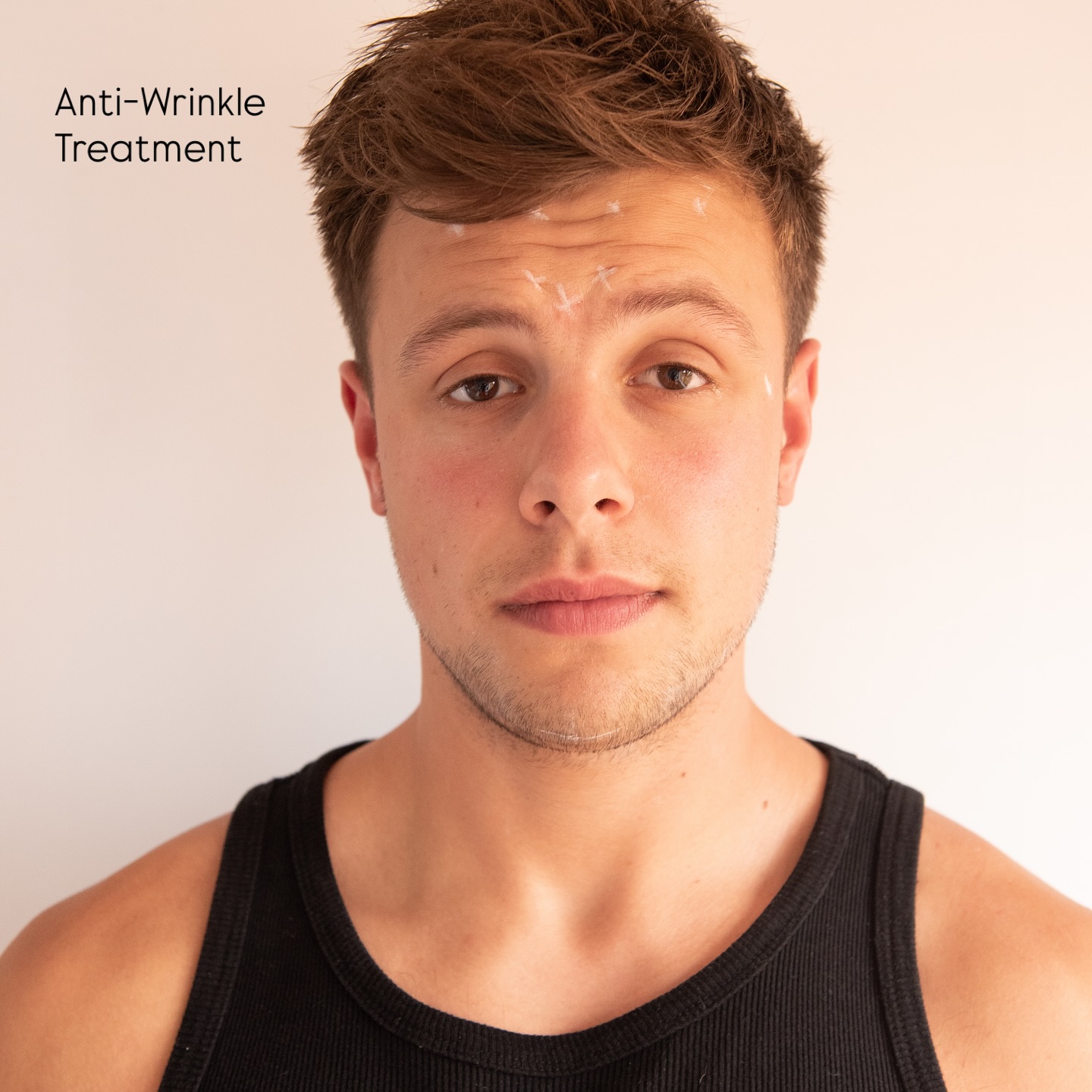 ✨ Everything You Need to Know About Anti-Wrinkle Treatments ✨
Often called “Botox,” anti-wrinkle treatment is a quick, non-surgical way to smooth facial lines by relaxing the muscles underneath.
Most popular areas treated:
• Forehead lines
• Frown lines (between the brows)
• Smile lines / crow’s feet
Other areas we can treat:
• Gummy smile
• Bunny lines (on the nose)
• Downturned corners of the mouth (DOA)
• Chin wrinkles
• Upper lip fine lines
The treatment:
• Takes just 15–20 minutes
• No numbing cream required
• Little to no downtime
Results:
• Full results appear in 1–2 weeks
• A top-up may be needed for optimal results
• Effects last up to 3 months
Educational content. Consultation required
𝖬𝗂𝖽𝗅𝖺𝗇𝖽 𝖠𝖾𝗌𝗍𝗁𝖾𝗍𝗂𝖼𝗌 𝖢𝗅𝗂𝗇𝗂𝖼 𝖢𝗈𝗏𝖾𝗇𝗍𝗍𝗒
✩ 𝖬𝖾𝖽𝗂𝖼𝖺𝗅 𝖯𝗋𝖺𝖼𝗍𝗂𝗍𝗂𝗈𝗇𝖾𝗋 𝖫𝖾𝖽 𝖠𝖾𝗌𝗍𝗁𝖾𝗍𝗂𝖼𝗌
✩ 𝖥𝗎𝗅𝗅𝗒 𝖨𝗇𝗌𝗎𝗋𝖾𝖽 𝖢𝗈𝗌𝗆𝖾𝗍𝗂𝖼 𝖢𝗅𝗂𝗇𝗂𝖼
✩ 𝖯𝗋𝗂𝗏𝖺𝗍𝖾 𝖺𝗇𝖽 𝖢𝗈𝗇𝖿𝗂𝖽𝖾𝗇𝗍𝗂𝖺𝗅
#AntiWrinkle #Botox #BotoxTreatment #WrinkleFree #SmoothSkin #YouthfulSkin #AestheticTreatment #FacialRejuvenation #SkinCareGoals #GlowUp #BeautyTips #NonSurgical #CosmeticTreatment #SkinCareRoutine #ConfidenceBoost