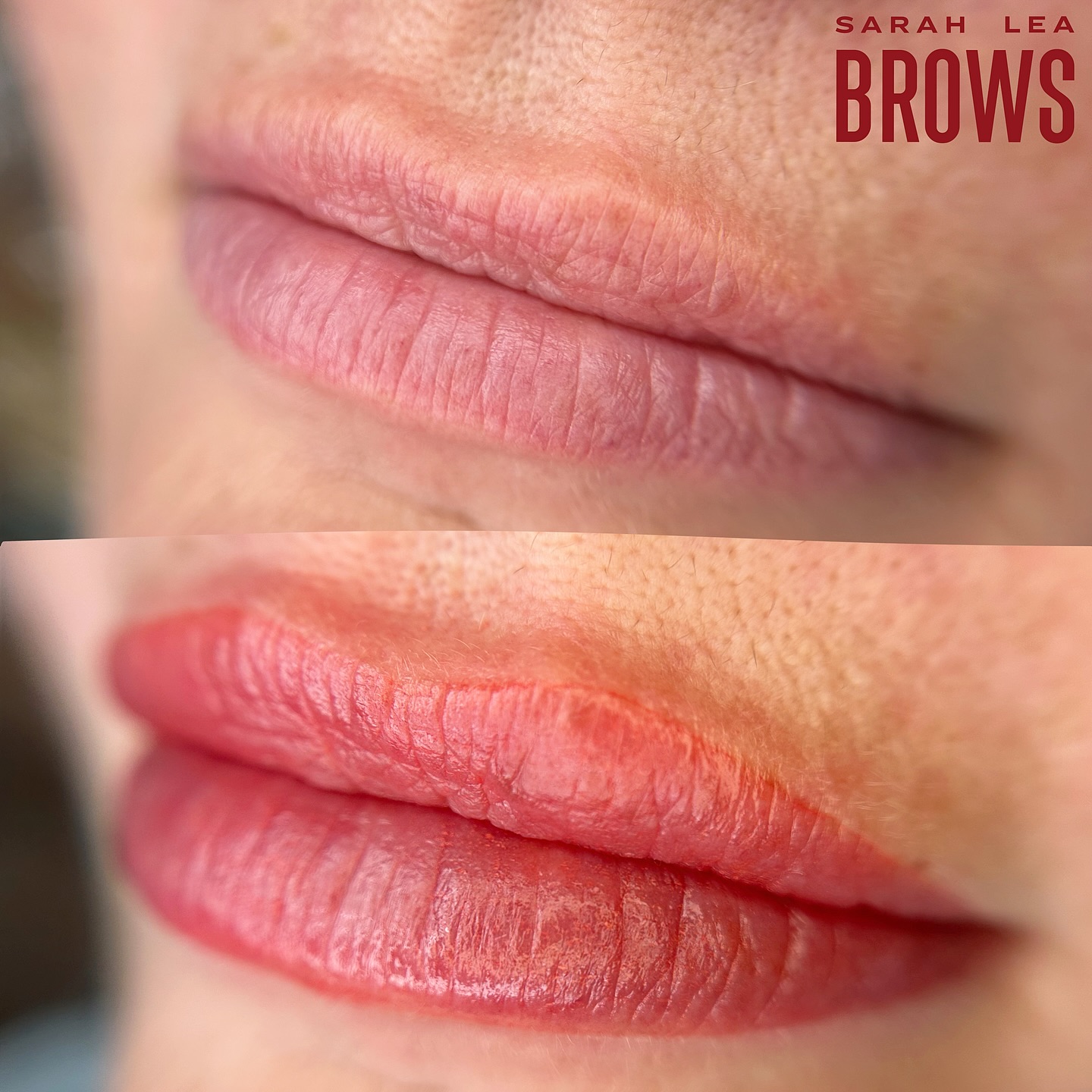 A gorgeous little lip neutralisation on a client with purple/cool toned undertones present in her lips.
If your natural lip tone leans cool toned (blue/purple), lip blush tattoo can do more than just add a pretty tint. Lip neutralisation works by expertly colour correcting those tones to balance and âcancel outâ those undertones first, so your healed result looks warmer, brighter and more youthful.
Sometimes this is required to balance out the lip tissue before hitting it with your âtarget colourâ at the second session.
Do you notice peoples lip undertones, or are you normal? đŤ đŠđŤŁ