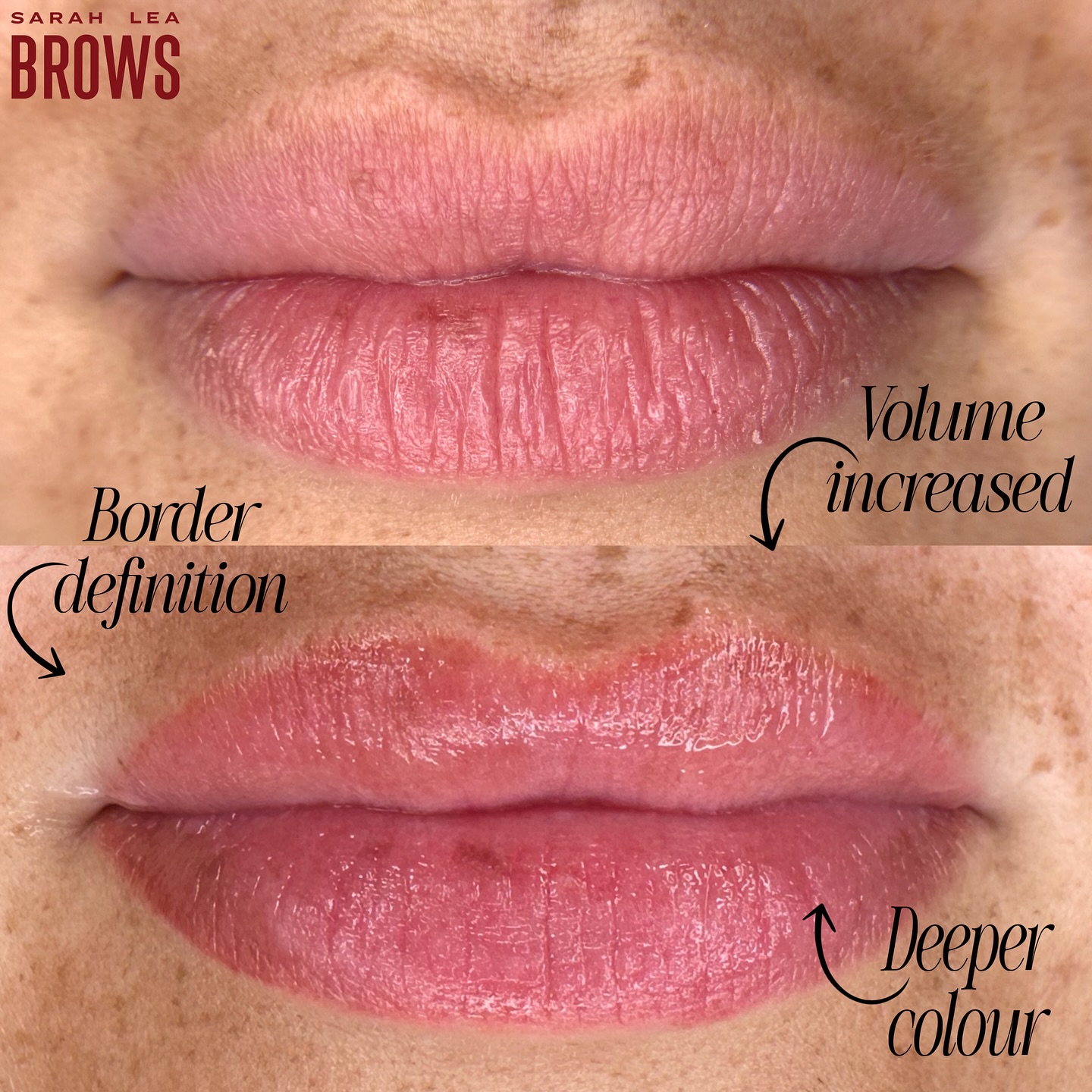 Lip blush up close đ
This is before and after of a healed lip blush tattoo, after 1 session.
No matter the goal, whether its volume, colour, tone, border definition or all of the above⌠the end result (in my humble opinion) should still always look natural. Think: your lips, but better đŠââ¤ď¸âđâđŠ
When it comes to aesthetics, itâs the small tweaks and most subtle adjustments that create the biggest impact. The kind of results that donât scream obvious, but that leave people thinking youâre naturally gifted in the genetics department - those results are my JAM.
Book a free consult at the link in bio and letâs make magic together đŞ