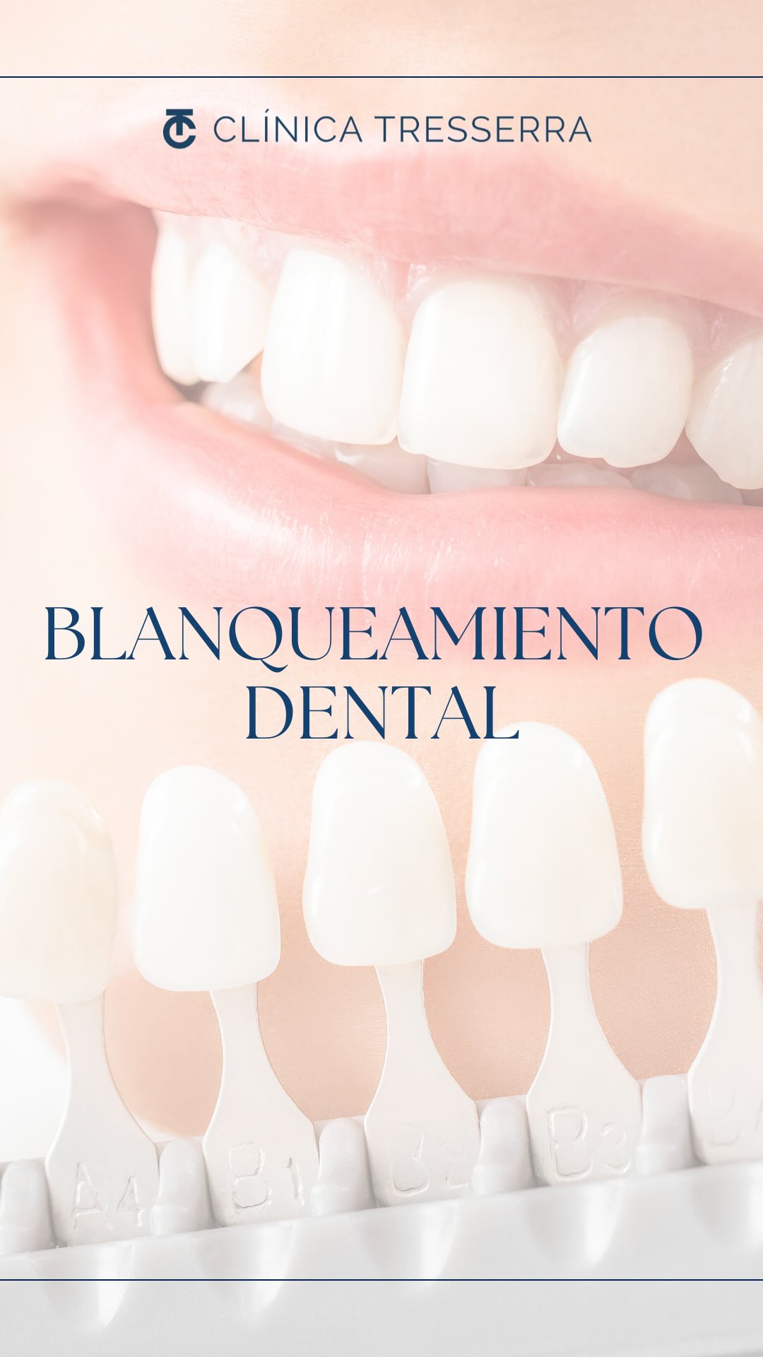 ✨ ¿Sabías que una sonrisa más blanca puede rejuvenecer tu rostro hasta 5 años? ✨
El blanqueamiento dental profesional es la forma más segura y efectiva de devolverle a tus dientes su brillo natural.
En nuestra clínica utilizamos tecnología avanzada que consigue resultados visibles desde la primera sesión, cuidando siempre la salud de tu esmalte🦷💙
Este mes de octubre es el momento ideal para invertir en ti: despídete de las manchas causadas por el café, el té o el tabaco y recibe el otoño con una sonrisa luminosa🍂
📲 Reserva tu cita ahora y asegura tu plaza.
✨Tu nueva sonrisa te está esperando.
#clinicatresserra #clinicadental #dientesperfectos #blanqueamientodental #blanqueamientos #blanqueamientosdentales #blanqueamientoláser #blanquemientodentalbarcelona