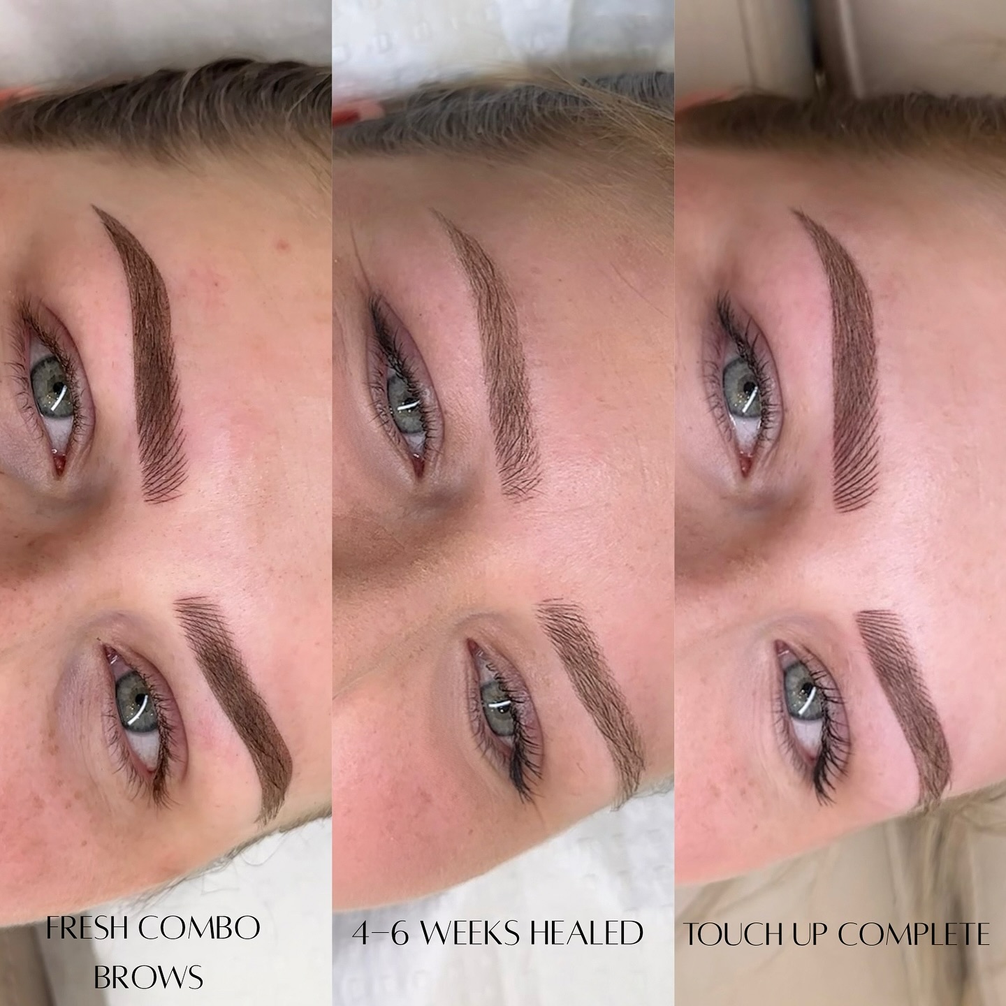 The HEALING process!
Perfect example of why you shouldn’t be scared of your brows looking darker right after your PMU session — this is necessary and only temporary!
In the first week, the pigment sits on top of the skin before it begins to heal and settle in. As the skin naturally exfoliates, the brows will soften in color, usually by up to 40–60%.
The final, healed result will look much more natural and tailored to your features. So, think of the early darkness as just part of the journey to your perfect brows!
#adelaidebrows #southaus #adelaidebeauty #eyebrow #eyebrows #makeup #beauty #microblading #brows #eyelinertattoo #eyebrowshaping #permanentmakeup #lashes #cosmetictattooadelaide #pmu #brow #cosmetictrainingadelaide #PMUtraining #adelaidepmumasterclass #eyebrowtattoo #micropigmentation #browsonpoint #northadelaide #nanobrowsadelaide #nanotattoo #tattooremoval #laser