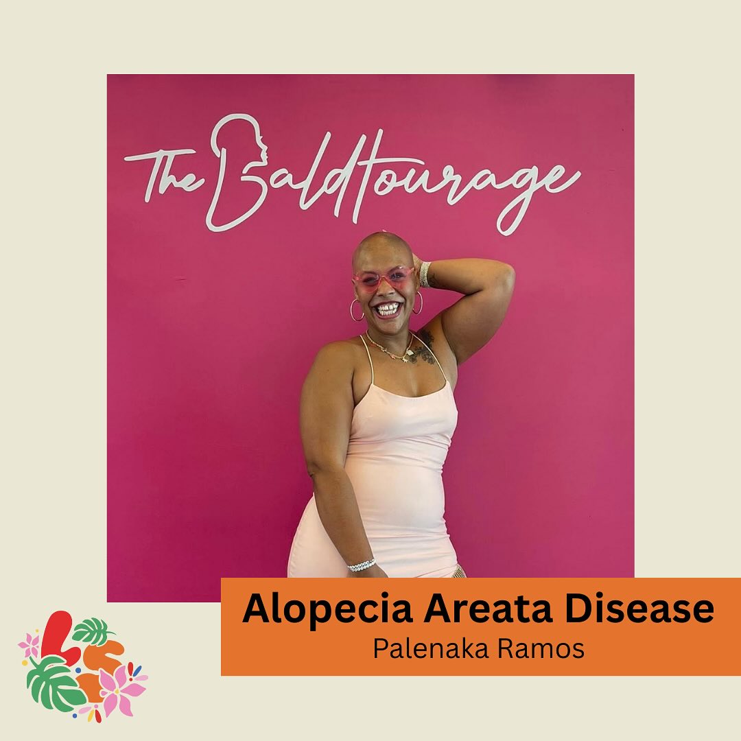 ALOPECIA AREATA DISEASE
.
.
.
Palenaka Ramos is so proud of her baldness that it has become a source of pride for her. She actively engages in educating the community about alopecia | @palenakaaaa
.
.
.
Nationally 🌿: Puerto Rico
.
.
.
Link: https://youtube.com/shorts/87ztN5Y21Ic
.
.
.
#latinesordos #latinespotlight #wecan #latinoamérica #latino #latinownedbusiness #hispanicheritagemonth #latinesordoscan