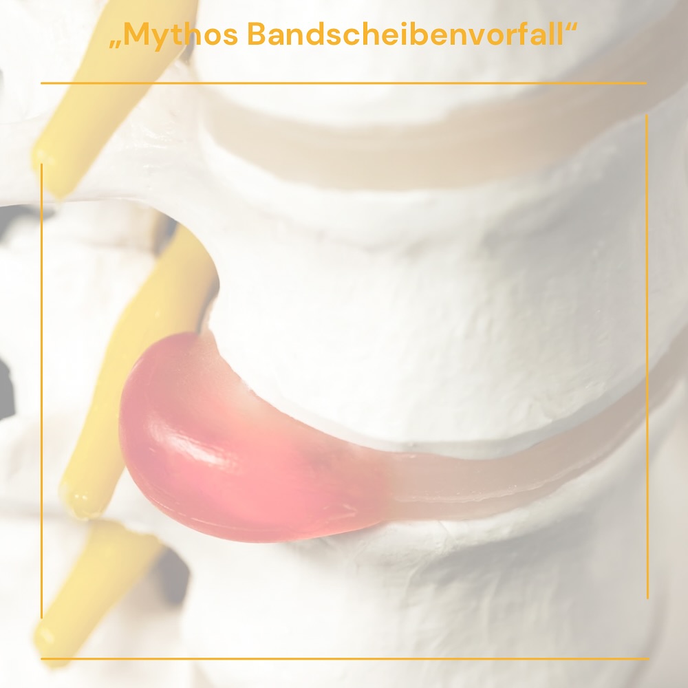 🧠 Mythos: „Mit Bandscheibenvorfall darf man keinen Sport mehr machen.“
❌ Falsch!
🔍 Was wirklich stimmt:
Bewegung ist essentiell für die Heilung.
Schonende, gezielte Übungen aus der Physiotherapie helfen, Muskeln aufzubauen & die Wirbelsäule zu stabilisieren.
Ruhigstellen & Schonung machen es oft schlimmer.
✅ Fazit: Mit der richtigen Therapie & Anleitung kann Bewegung bei Bandscheibenproblemen sogar der Schlüssel zur Besserung sein.
💬 Hättest du gedacht, dass Bewegung hier die Lösung ist?
#Bandscheibenvorfall #Physiotherapie #Gesundheit #FitnessMythen