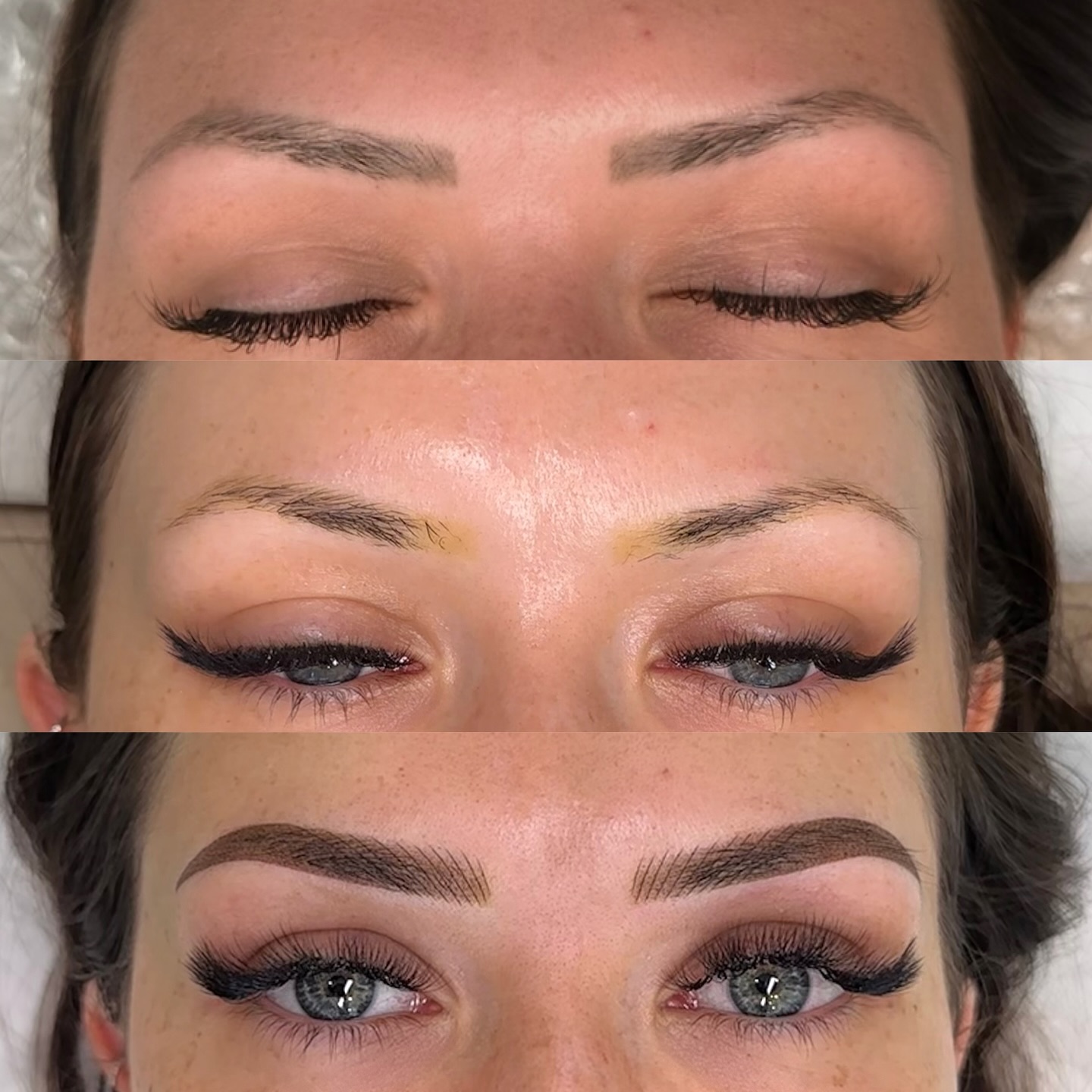 When patience pays off!
From this client’s previous microbladed brows (not our work) ➡️ to laser removal ➡️ to finally achieving a stunning set of combination brows (machine hairstrokes + ombré powder).
Laser removal can feel like a long journey, but in most cases, it’s an essential step for the best possible results.
Trust. The. Process. 💫 The transformation will be so worth it!
#adelaidebrows #southaus #adelaidebeauty #eyebrow #eyebrows #makeup #beauty #microblading #brows #eyelinertattoo #eyebrowshaping #permanentmakeup #lashes #cosmetictattooadelaide #pmu #brow #cosmetictrainingadelaide #PMUtraining #adelaidepmumasterclass #eyebrowtattoo #micropigmentation #browsonpoint #northadelaide #nanobrowsadelaide #nanotattoo #tattooremoval #laser
