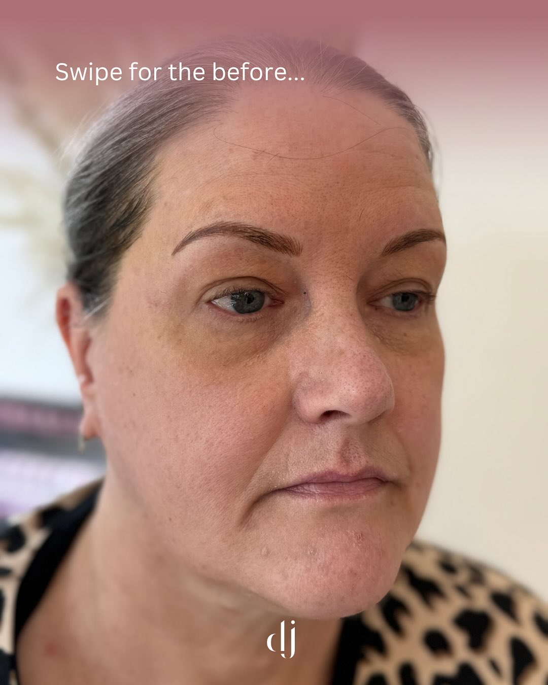 Brows before & after
DM for Enquires
Book via our booking link above ⬆️
#pmu #pmubrows #pmumakepermanentemakeup #permamentmakeup #microblading #hairstroke #ombrebrow #hyperealism #hyperealbrows #pmuuk
