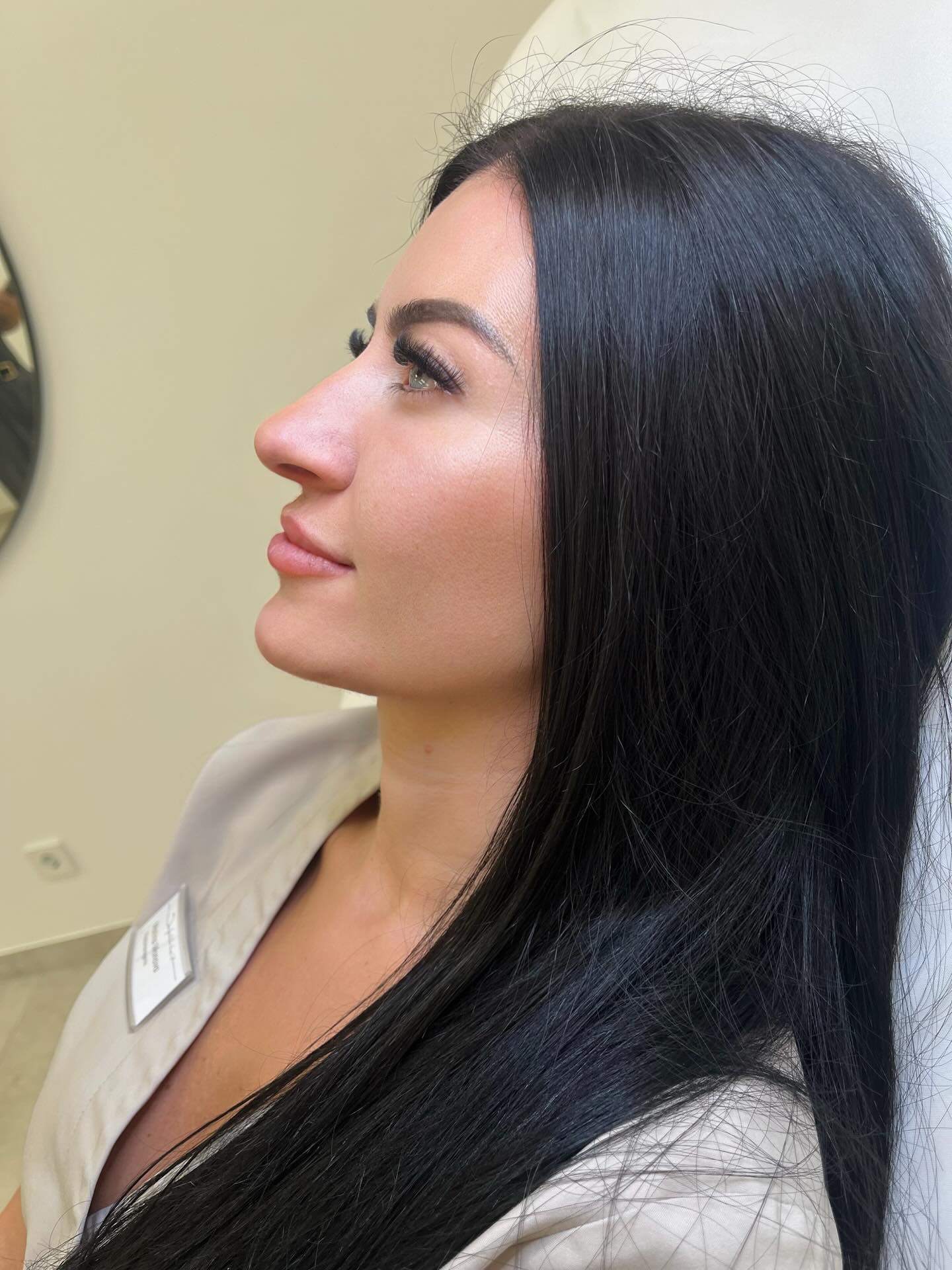 Kinnaufbau 💉
#kinn #beauty #bamberg #nürnberg #filler #heilpraktiker