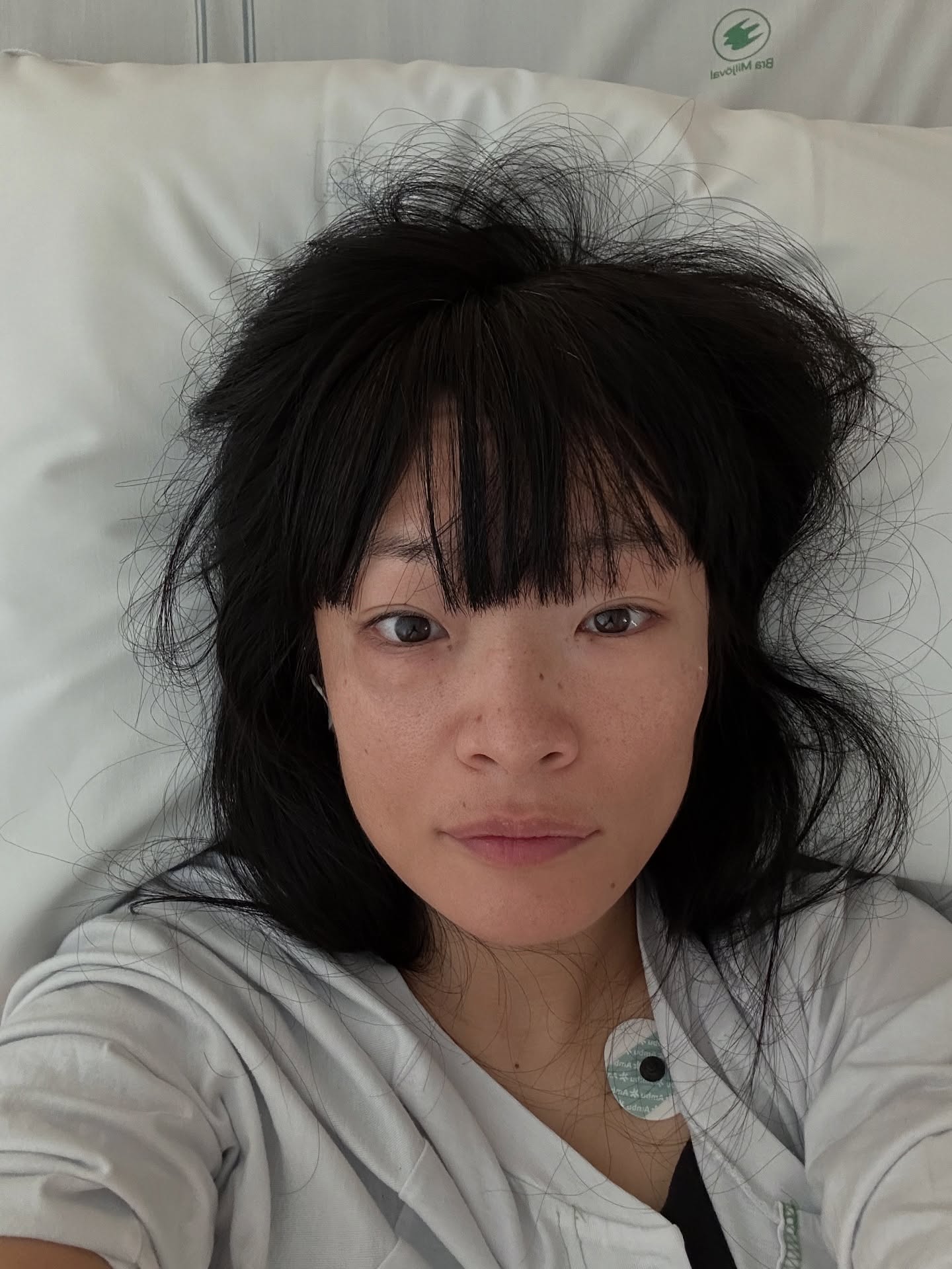 (手術報告 - 日本語は下↓) Thank you so much to everyone who reacted to my stories and sent me kind messages 🙏Here’s a little update.
On Sunday night (Sept 28), right after Taiko practice, I suddenly had terrible abdominal pain in my friend’s car. I turned pale and was rushed straight to the emergency room. Before I even knew what was happening, I was in surgery — and woke up at 2:30am.
The next day the doctors told me it was massive internal bleeding caused by a uterine myoma. I had lost 2.5 liters of blood. To give you an idea: losing 30% of your blood is already considered life-threatening… and I lost over 50% in such a short time. Pretty scary.
In a way I was very lucky — the bleeding started in my friend’s car, the hospital had a bed available, and I got treatment immediately. I’m also deeply grateful to my husband who rushed over and has been taking such good care of me.
I was discharged already on Tuesday night, but I’m still in a lot of pain and weak from blood loss. Recovery will take some time.
I had just finished producing the “Nordic Hayashi” project that I worked on for half a year, and was hoping to share a happy post here. But maybe this is some kind of message from above — so for now, I’ll focus on resting and healing.
Thank you again for your kindness 💕
———-
�ストーリーズに載せた写真に反応し、お見舞いを送ってくださった方々へのお礼も兼ねて、ご報告です。
9/28日曜の夜、太鼓の練習のあと、送ってくれた友人の車の中で突然激しい腹痛に襲われて青ざめ出し、そのまま急患に運び込まれました。何が起きているかわからないまま緊急手術を受け、明朝2時半に目が覚めました。
翌日の説明で聞いたところによると、子宮筋腫による体内での大量出血で、一気に2.5リットルの血を失ったとのこと。全体の血液の30%以上が生命の危機と言われているので、50%以上を短期間で失ったのはかなりヤバかったようです。
因みに私は血を見るのが怖くて脈も自分で測れないヤツでして、小さい頃は少量の採血で倒れたり、献血も3度失敗しているほど自分の血が抜かれたり血を感じるのが苦手なので、自分に起きたことを考えるだけで恐ろしい!(笑)
出血が起きたのが友人の車だったこと、病院に空きがあり、すぐに処置を受けられたことなどは本当に運が良かったとしか言えません。すぐに駆けつけ、献身的に介護してくれた夫にも感謝です。
火曜の夜には退院させられたのですが、まだ術後の痛みと虚血で力が出ず、回復には至っておりません。
半年がかりでプロデュースした「北欧囃子」プロジェクトが無事に成功に終わったところでしたので、本来はFacebookでハッピー投稿をする予定だったのですが、これも何らかの天からの啓示だと受け止め、当面は無理せず、回復に努めようと思います🫡