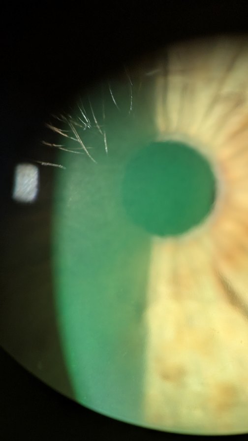 Breaking news: if this popped up on your feed, you’ve officially been drafted into the nerd squad 🔬🤓🪐 Membership perks? Cool glasses, endless science facts, and bragging rights for the best eye jokes 👁✨ Don’t blink—you’re one of us now 👓💡
#EyeNerd #ScienceIsCool #nerdyandproud
#NerdLife #GeekChic #ScienceNerd #EyeTalkDoc #EyeCareTips #HealthyEyes #ReelLife #relatablereels