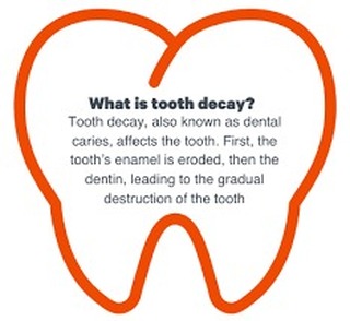 Facts to remember for your Dental Health. Book a consult. Go see your Dentist or Dental therapist today!