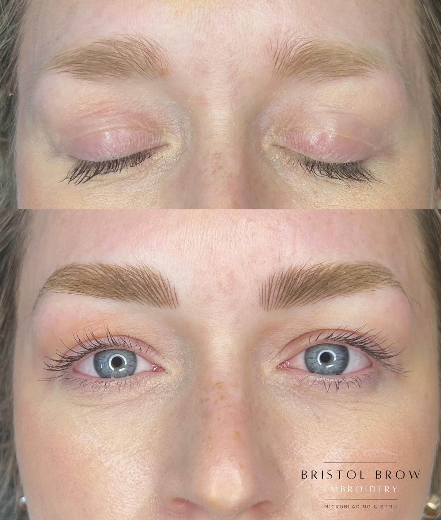 NANO BROWS for Emma 💛
As always, these will soften and fade for a gorgeous blonde Heal 👌
________________________
🗓️ BOOK NOW - Link in Bio (this shows next Availability)
🌐 Further Information on Services & Prices at www.bristolbrowembroidery.co.uk
🏡 Home-Based Studio in Westbury-on-Trym, Bristol
⭐️ Five Star Google Reviews
💬 DM or Text 07920575556 with further enquires
________________________
#hyperrealismbrows
#hyperrealistic #homebasedstudio #bristolmicroblading #bristolbrowembroidery #semipermanentmakeup #microbladingbristol #browsonfleek #bristolbeauty #homebeautystudio #bristolmakeupartist #browtransformation #semipermanentbrows #bristolglam #microbladinguk #homesalon #naturalbrows #sculptedbrows #bristolbeautyservices #bristolbeautytherapist #browenhancement #bristolsemipermanentmakeup #nanobrows #bristolnanobrows #naturalbrows