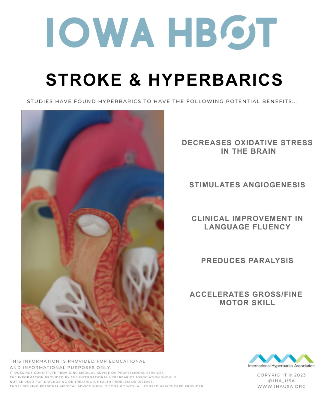 Check out this blog on Stroke & Hyperbarics: https://www.iowahbot.com/post/stroke-hyperbarics-1
Studies have found hyperbaric oxygen therapy to have the following potential benefits:
- Decreases oxidative stress in the brain
- Stimulates angiogenesis
- Clinical improvement in language fluency
- Reduces paralysis
- Accelerates gross/fine motor skills
Call us at 515-421-4018 to schedule a complimentary consultation.
#StrokeRecovery #HyperbaricOxygenTherapy #BrainHealth #IowaHBOT #CapitalHealth #DesMoines #DSMUSA #Iowa #NeuroHealing #Stroke #BrainRecovery #NeuroRehab #CognitiveHealth #MotorSkillRecovery #Neuroplasticity #StrokeSupport #HealingWithOxygen