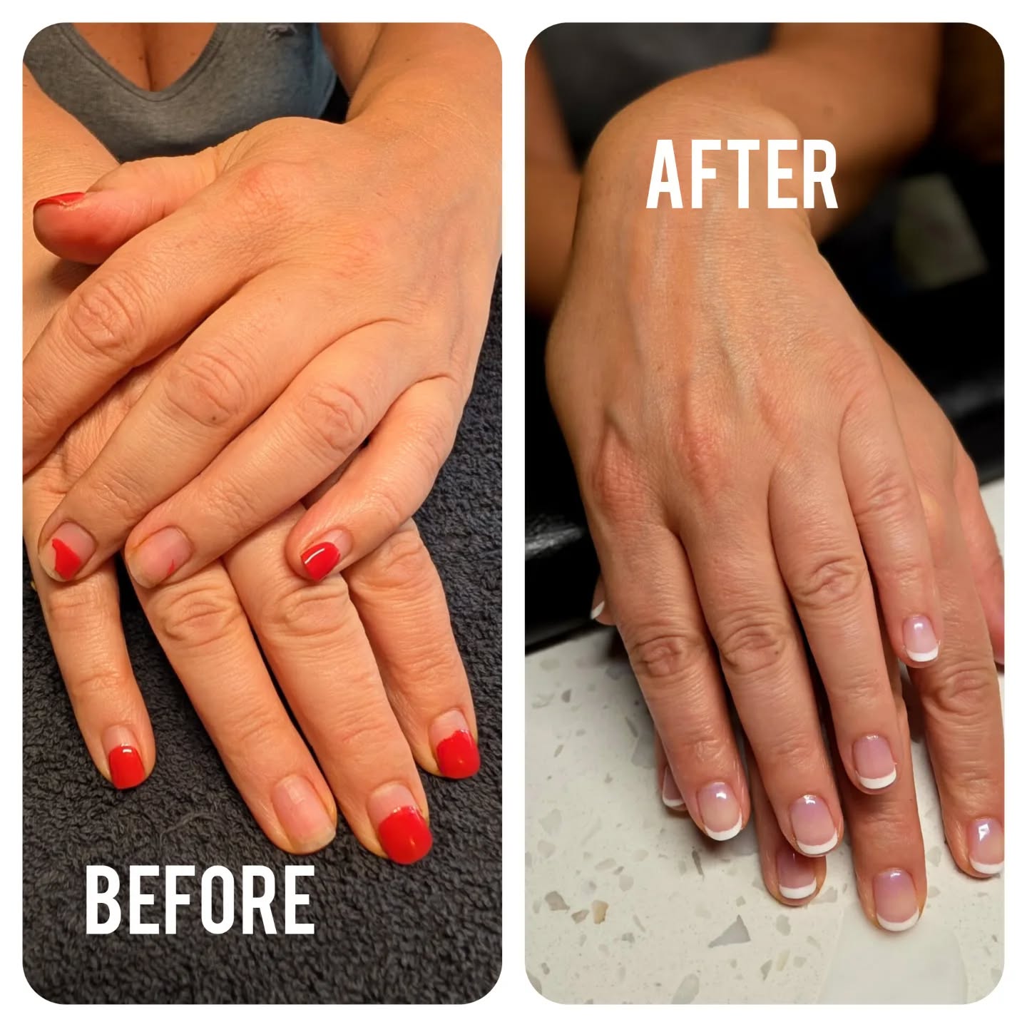 Transformation time!
From chipped polish ➝ to fresh & flawless French manicure.
Your hands deserve that glow-up too
LNO Boutique – Skin & Nail Care
#Manicure #FrenchManicure #NailTransformation #NailCare #BeforeAndAfter #NailGoals #NailSalon #HealthyNails #ColoradoNails #LNOBeauty #FreshNails #NailInspo