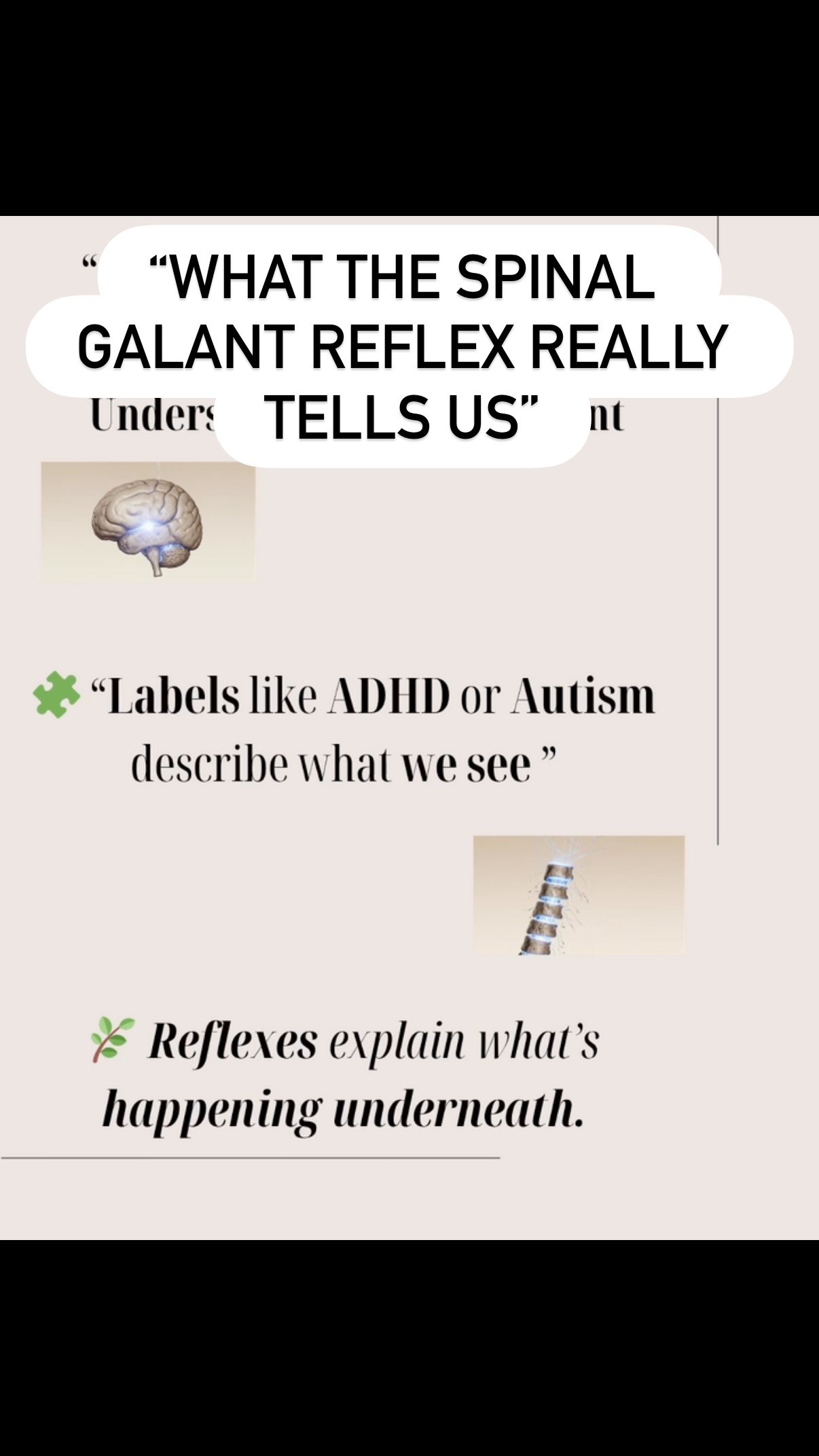 ✨ Fidgeting isn’t bad behavior — it’s communication.
When a child can’t sit still, wiggles constantly, or reacts to clothing and touch…
the body isn’t being “difficult.”
It’s asking for help through the language of the nervous system. 💫
The Spinal Galant Reflex is one of the most common underlying patterns I see in children labeled with ADHD, autism, or sensory processing challenges.
When it stays active, it creates a body that’s always ready to move — not because the child wants to misbehave, but because their nervous system can’t yet find calm.
Through gentle, consistent work, this reflex can be released.
And when it does…
🌱 Children begin to sit with ease
🧠 Focus with clarity
💬 Engage without tension
Join me this Thursday LIVE for a deep dive into how to recognize and release the Spinal Galant Reflex — and how calm truly begins in the body.
🎥 Exercise demo Wednesday
💬 LIVE Q&A Thursday
🕊️ Integration begins when we listen to the body’s story, not just the diagnosis#reflexintegration #BrainReconnection #HelaMethod #PrimitiveReflexIntegration #SpinalGalantReflex #ReflexIntegration #ADHD #AutismAwareness #SensoryProcessing #ChildDevelopment #Neuroplasticity #NervousSystemRegulation #TraumaInformedCare #ParentEducation #IntegrativeTherapy #ChildTherapist #ReflexTherapy #EmotionalRegulation #SomaticHealing #OccupationalTherapy #PediatricNeuroscience #HelaLive
