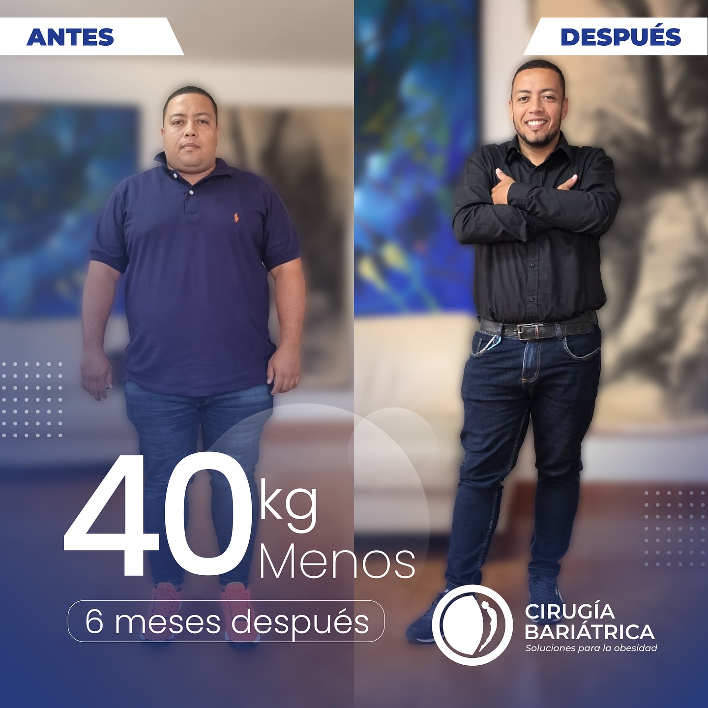 40 kg menos en solo 6 meses 💪 gracias a la cirugía bariátrica del Dr. Bolaños y su equipo, reconocidos por su alta calidad, profesionalismo y valores humanos que hacen posible cada transformación. 🌟
88 pounds lost in just 6 months 💪 thanks to the bariatric surgery by Dr. Bolaños and his team, recognized for their high quality, professionalism, and strong values that make every transformation possible. 🌟
#health #healthy #healthyliving #bariatrica #bariátrica #bariatric #weightlosssupport #weightlossjourney #healthychoices