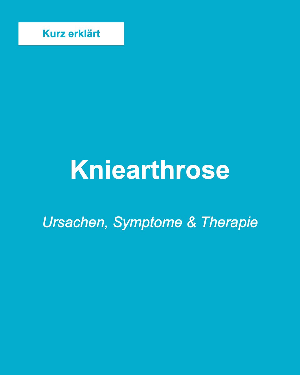 Kurz erklärt - Kniegelenksarthrose. ##knie #knieverletzung #knieschmerzen #arthroskopie #kreuzband #knieexperte #gelenke #operation #orthopaedie #knieoperation #profniemeyer #reha #rehabilitation #physio #arthrose #gonarthrose #meniskus #meniskusriss