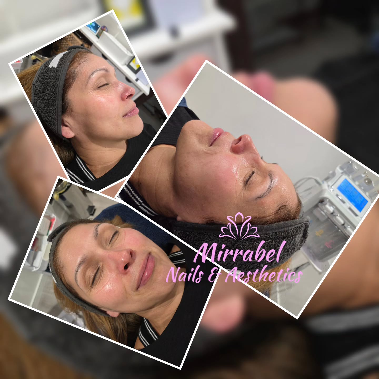 ⭐️GLOWING SKIN with HYDRO ULTIMATE FACIAL ⭐️
Rejuvenate your appearance and start fresh with healthy skin.
Hydro ultimate facial offers numerous benefits for skin, including deep cleansing, exfoliation, hydration and improved texture. It can help with issues like clogged pores, fine lines, wrinkles, and uneven skin tone, ultimately promoting a healthier, more radiant complexion.
#hydrofacial
#Altrinchamtoday #Hale #facialtreatment #skin #cloggedpores #dryskin #glowingskin #Wythenshawe