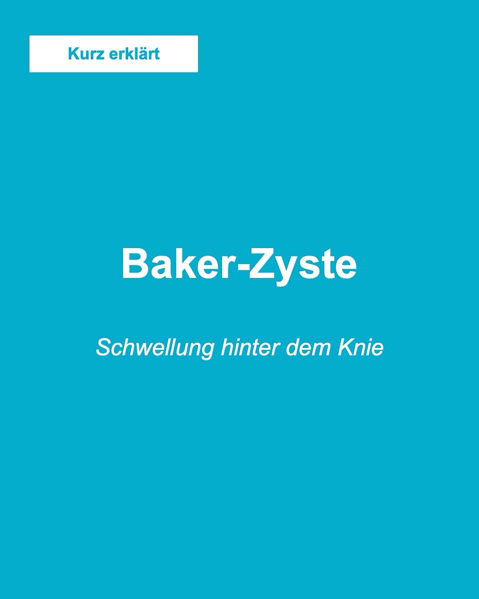 Kurz erklärt - Bakerzyste ##knie #knieverletzung #knieschmerzen #arthroskopie #kreuzband #knieexperte #gelenke #operation #orthopaedie #knieoperation #profniemeyer #reha #rehabilitation #physio #arthrose #gonarthrose #meniskus #meniskusriss