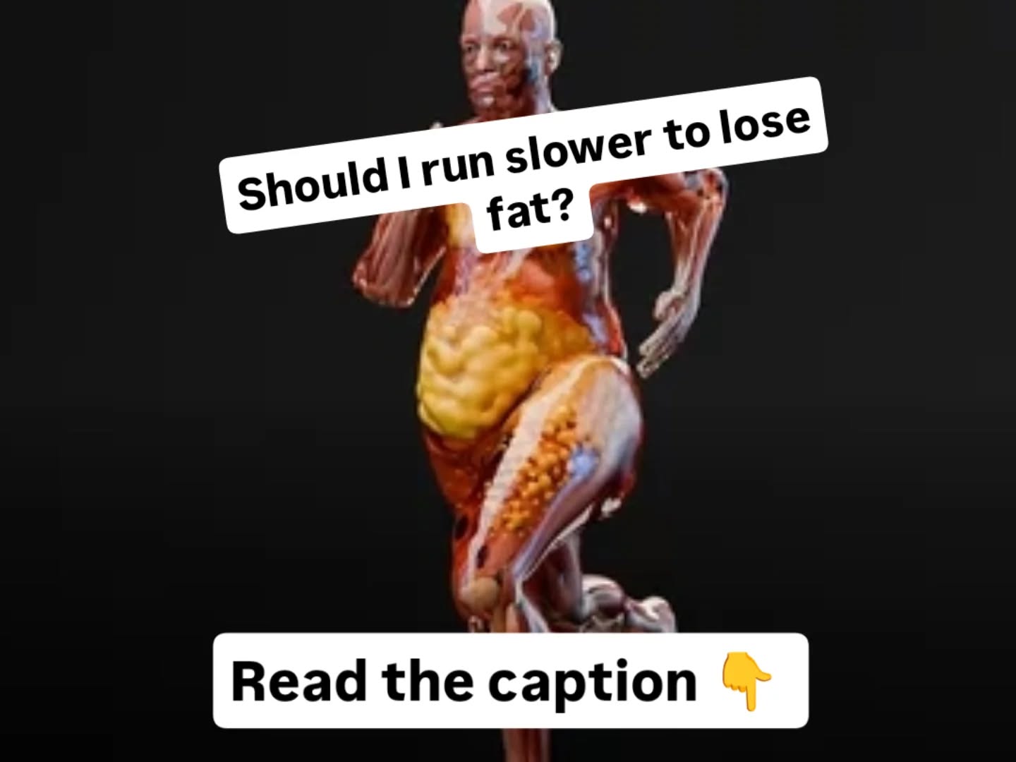 Let's get this coaching malarkey going a wee bit more...
Food for thought... Pun absolutely intended
People starting running for various different reasons. Challenge, weight loss, fitness goals so let's start to unpick some of the information out there.
Weight loss, I admit it is why I started running but...
🧠 Running for weight loss. Does running slower burn more fat? 🏃♂️🔥
📚 A classic study by Romijn et al. (1993) showed how our bodies fuel exercise at different intensities in well trained athletes. This is what they found:
✅ Low-intensity running (~25% VO₂ max) taps into fat stores most efficiently and uses it as a primary source of energy.
✅ As intensity rises, carbs take over—muscle glycogen and blood glucose become the primary fuel.
✅ At moderate intensity (~65% VO₂ max), fat oxidation is still strong, but fat (triglycerides) join the mix.
❌ At high intensity (~85% VO₂ max), fat use drops sharply and carbs dominate.
💡 So should you always run slow to lose fat?
Not quite. While slower runs burn a higher percentage of fat, total caloric burn matters more for fat loss.
🔥 Example: (numbers are for the example)
A 30-min slow run might burn 300 kcal with 60% from fat = 180 kcal from fat.
A 30-min faster run might burn 500 kcal with 40% from fat = 200 kcal from fat.
👉 Higher intensity = more total calories burned, even if the fat percentage is lower.
🧐 Now there are limitations to this study. For example, there are only 5 participants in the study and they are all "well trained". Consideration for coaching should always be to tailor the approach to the individual and their circumstances but the underlying points stand.
🎯 Smart strategy:
- Use slower runs to build endurance and help prioritise fat utilisation.
- Use faster runs to boost overall energy expenditure and fitness.
- Mix both for sustainable fat loss and performance gains.
#FatLossRunning #RunSmart #EnduranceTraining #MetabolicFlexibility #RomijnStudy #RunningCoachTips #TrainWithScience #CaloricBurnMatters