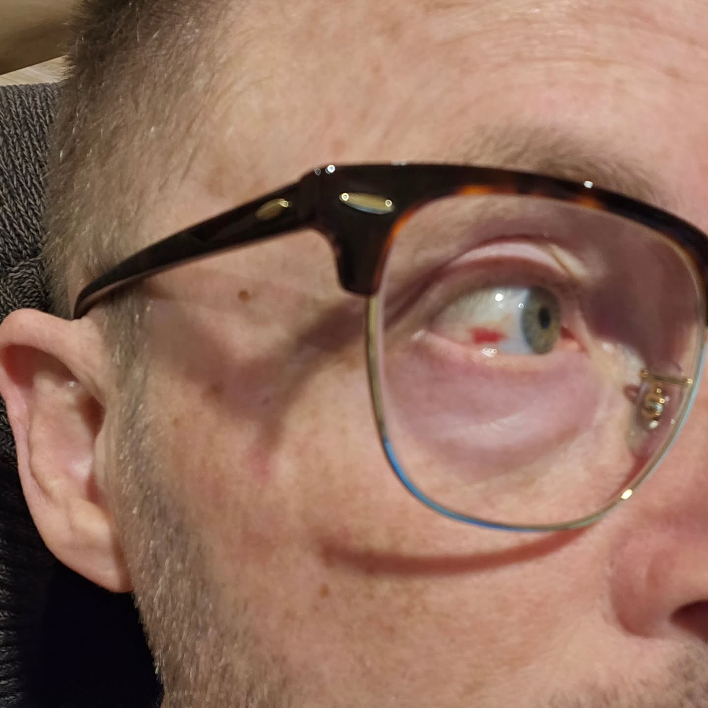 How do you know that you forced hard enough at the gym? You blow a vein out in an eye. I guess I can relax while I work today 😎