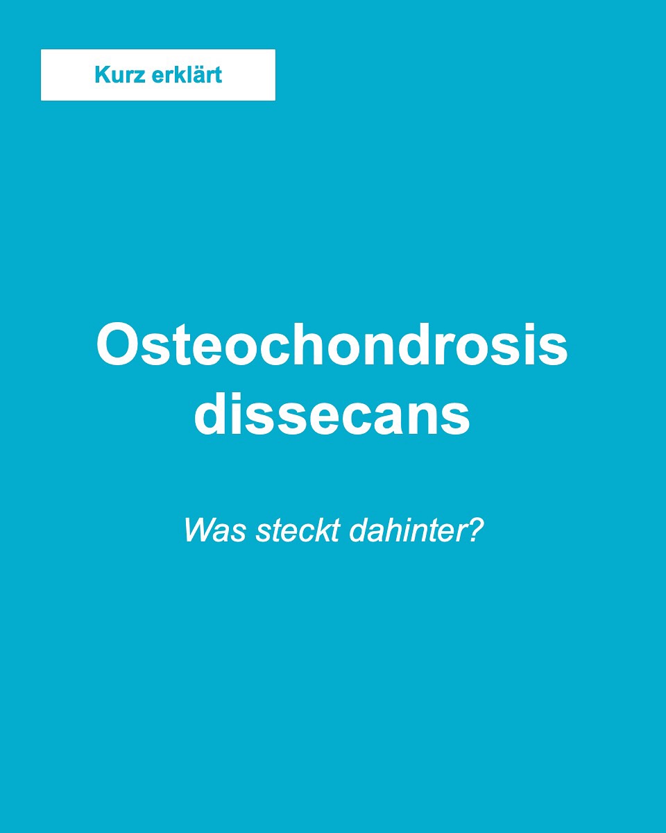 Kurz erklärt - Osteochondrosis Dissecans
##knie #knieverletzung #knieschmerzen #arthroskopie #kreuzband #knieexperte #gelenke #operation #orthopaedie #knieoperation #profniemeyer #reha #rehabilitation #physio #arthrose #gonarthrose #meniskus #meniskusriss