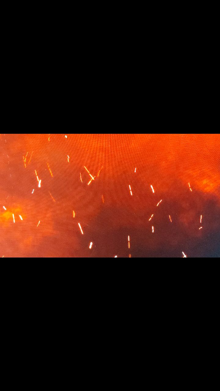 Several years ago, I was using anatomically constrained magnetoencephalography (aMEG) to record brain activity in a patient with a genetic disorder. During the procedure, he abruptly stopped talking to me and stared off. I asked him if he was okay, and he said, "The electricity's coming..." and then he had a seizure. Our fortuitous and completely unexpected recording of his seizure using this rare technology that localizes brain activity with millisecond temporal resolution helped pinpoint the source of his seizures. We integrated his MRI brain anatomy scans with this physiological MEG activity recording, which helped his neurosurgeons to find and remove the bad brain tissue (the epileptogenic focus). When I saw him last, he hadn't had a seizure in three years. I'm still struck by his courage and clear-eyed choice of words when he felt a seizure beginning. 🧠⚕️
#motoroverflow #ictal #meg #ameg #epilepsy