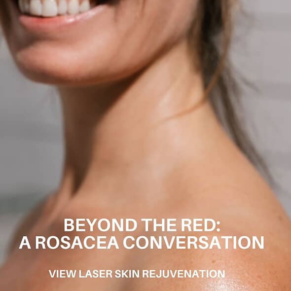 Thank you to everyone who joined us for our rosacea event last week! We loved hosting you to share education and the latest in rosacea treatment options. We’re looking forward to future events — let us know what you’d like to learn more about next!