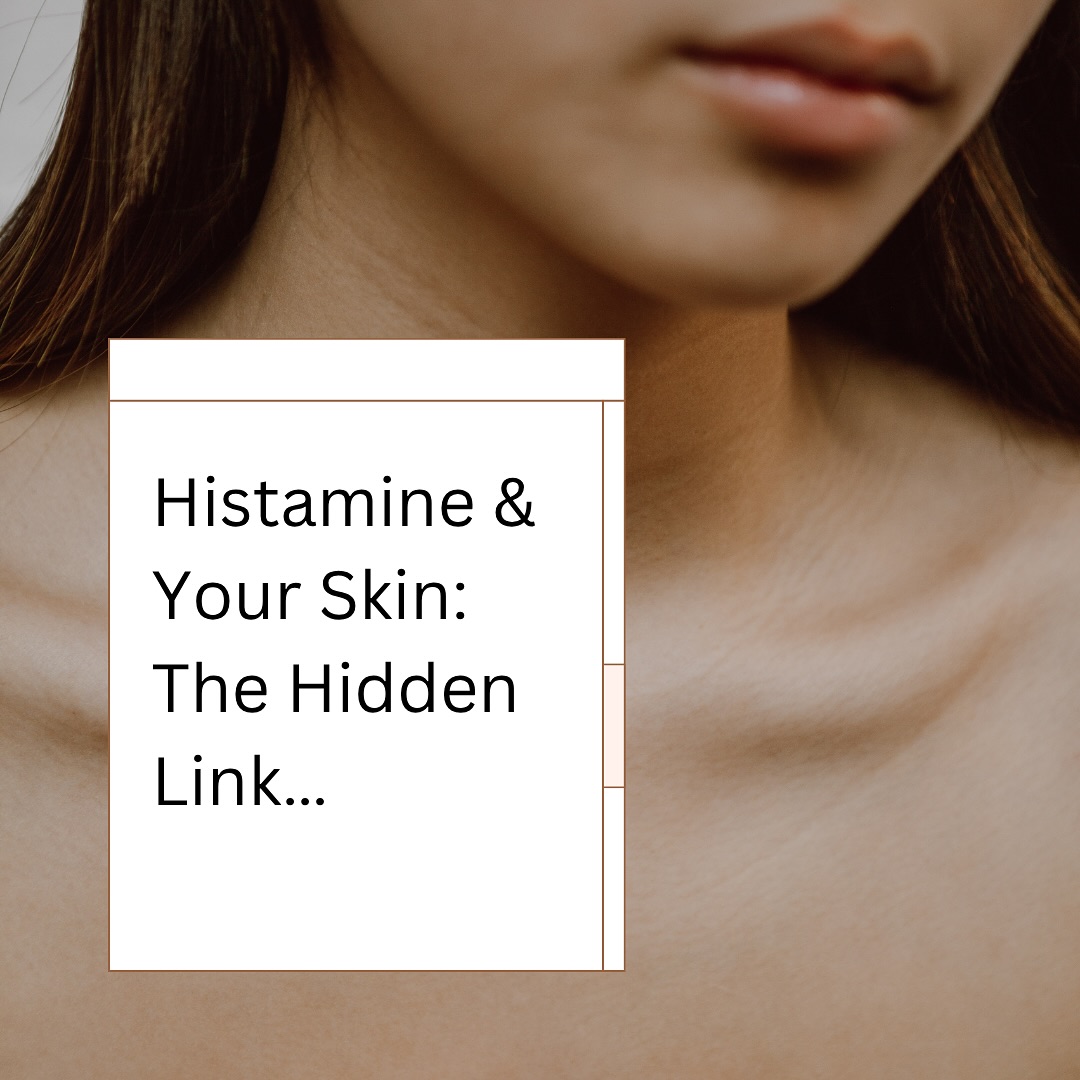Histamine might be the missing link in your skin story!
If you’re dealing with persistent redness, breakouts, itching, flushing, or skin that seems to “react to everything,” it might not just be your skincare.. it could be histamine overload.
Histamine isn’t just about allergies. It’s a powerful messenger involved in immune function, digestion, hormones, and inflammation. But when it builds up faster than your body can clear it, it often shows up on the skin.
👉 Here’s how:
* Gut imbalances reduce DAO, the enzyme that breaks down histamine.
* Liver detox pathways become sluggish, slowing clearance.
* Oestrogen dominance amplifies histamine activity.
* Chronic stress activates mast cells to release more histamine.
The result? A constant inflammatory signal driving skin sensitivity, hormonal breakouts, and flare-ups that don’t fully resolve.
The good news is, histamine balance is something you can support:
* Increase histamine breakdown with quercetin, zinc, vitamin C, and bioflavonoids.
* Support gut and liver function to improve clearance.
* Reduce high-histamine foods and histamine liberators.
* Regulate stress and calm the nervous system to slow mast cell activation.
Your skin is never acting in isolation.. it’s responding to deeper signals inside the body. When you address histamine balance, the skin often follows.
#histamineintolerance #histamineskin #skinhealth #acnejourney #acneskincare #naturopathicmedicine #holisticskin #tcm #guthealth #liverdetox #hormonehealth #naturalskincare #holisticskinhealth #acnesupport #skininflammation #daoenzyme #bioflavonoids #quercetin #skineducation #skinhealingjourney